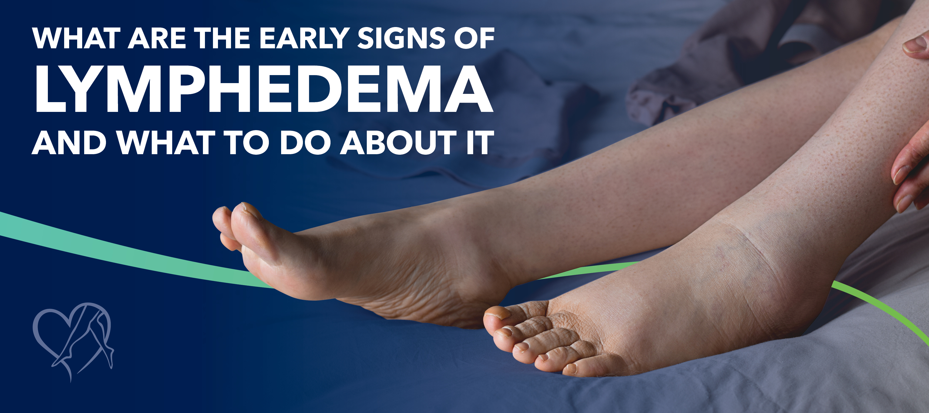Blog Image What Arethe Early Signsof Lymphedemaand Whatto Do About It