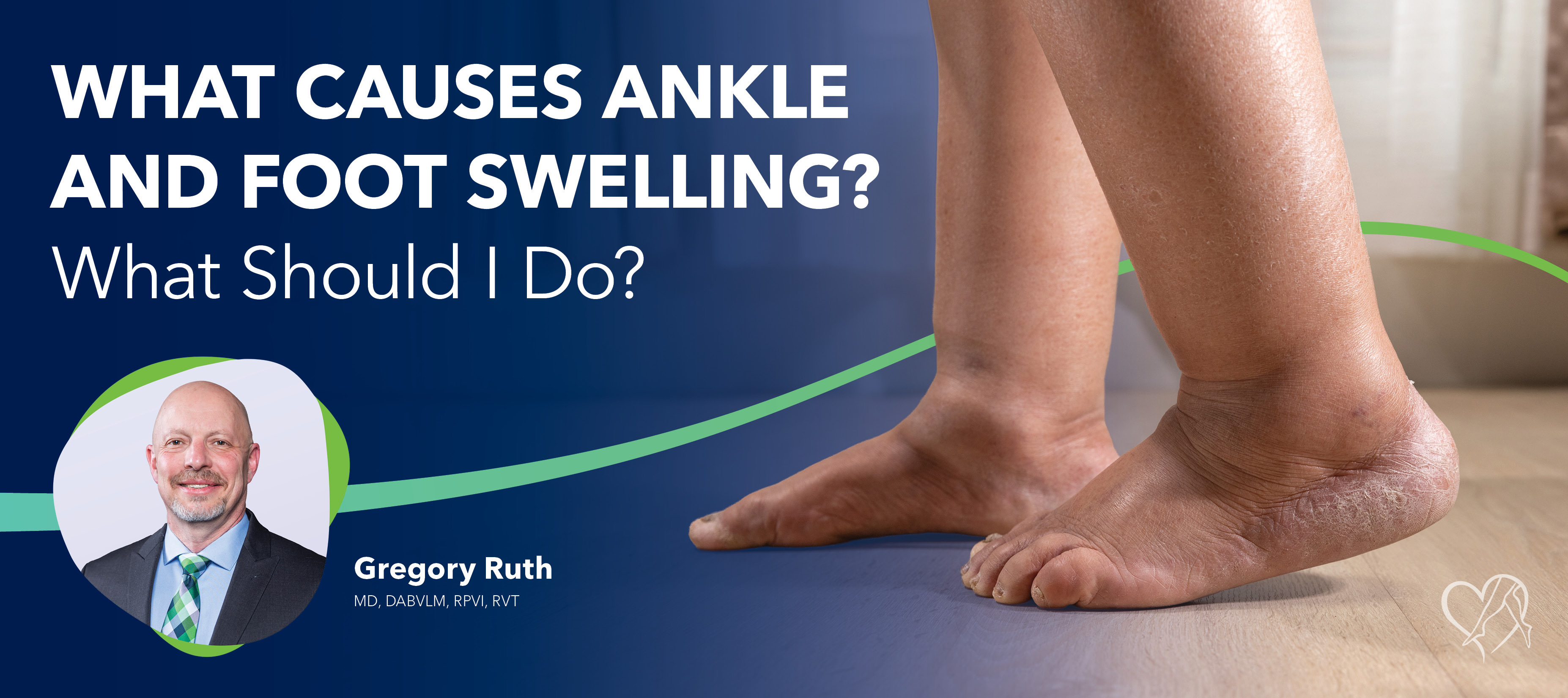 Blog Image What Causes Foot And Ankle Swelling