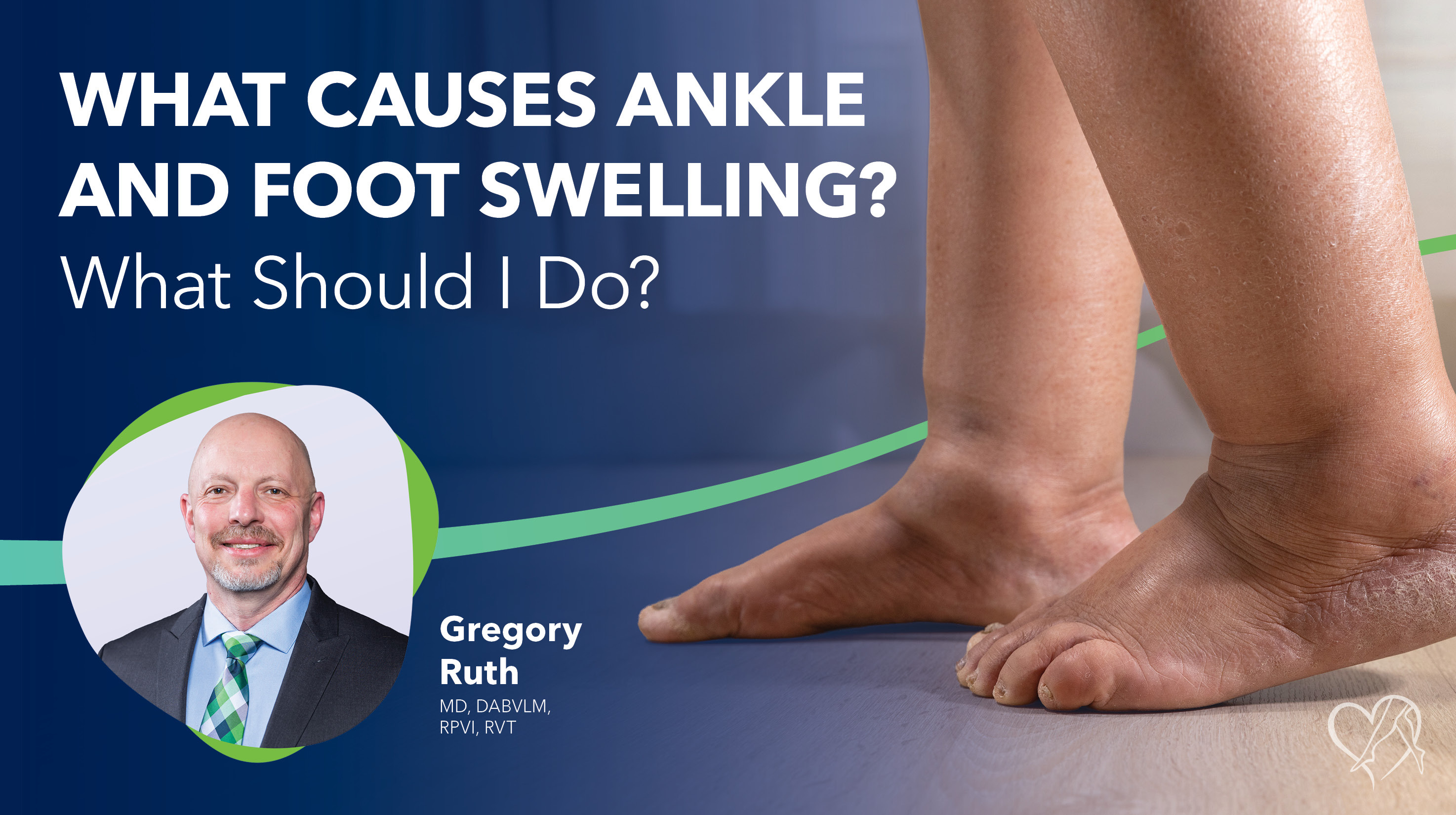 Blog Image What Causes Foot And Ankle Swelling Thumbnail