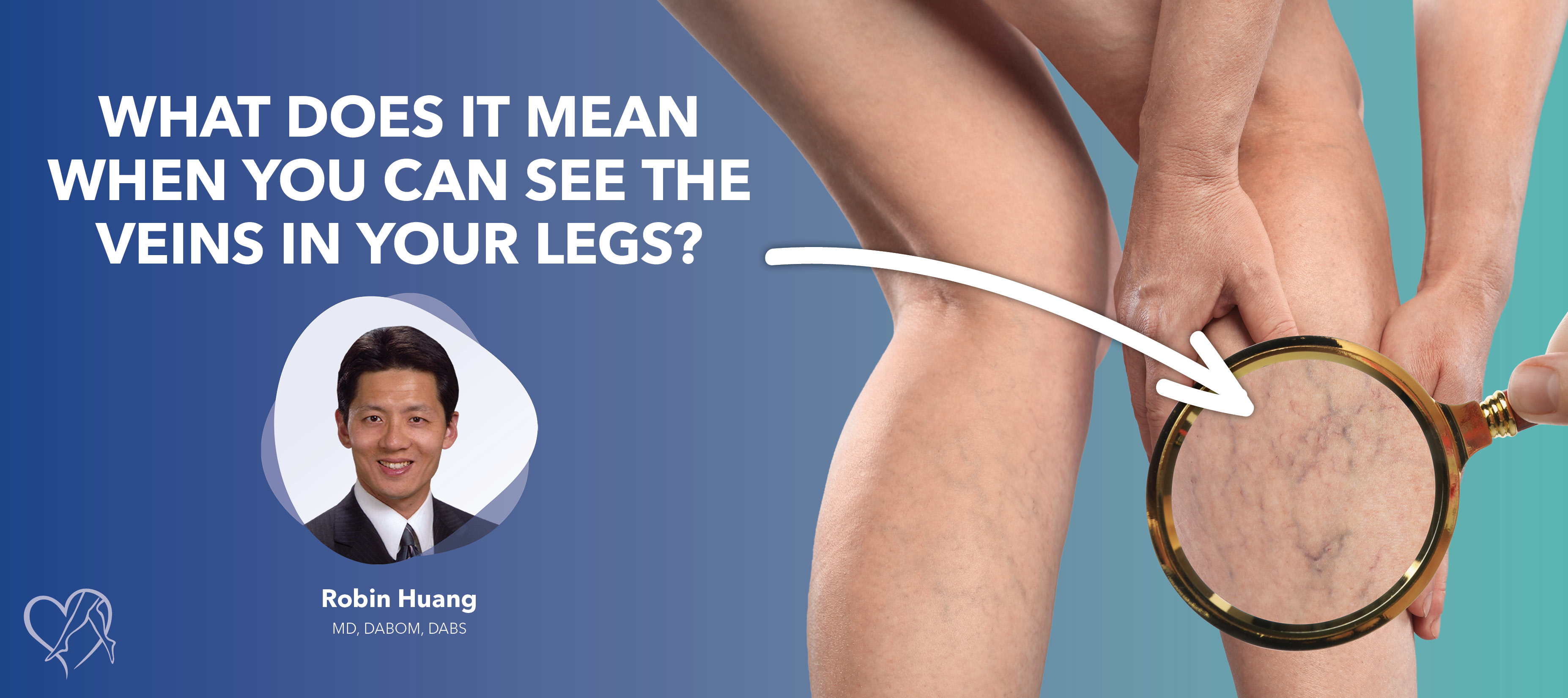 Blog Image What Does It Mean When You See The Veins In Your Legs
