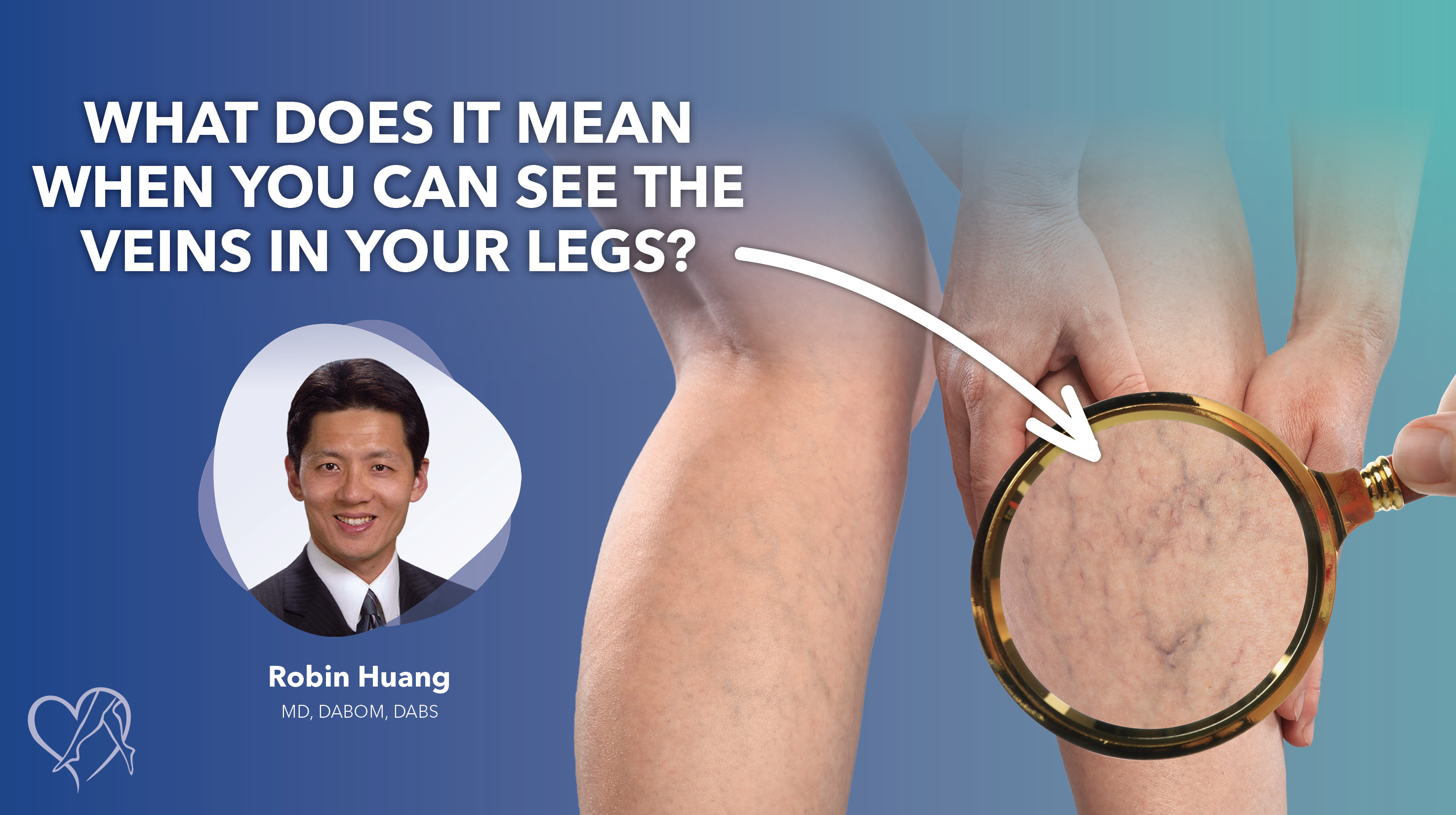 Blog Image What Does It Mean When You See The Veins In Your Legs Thumbnail