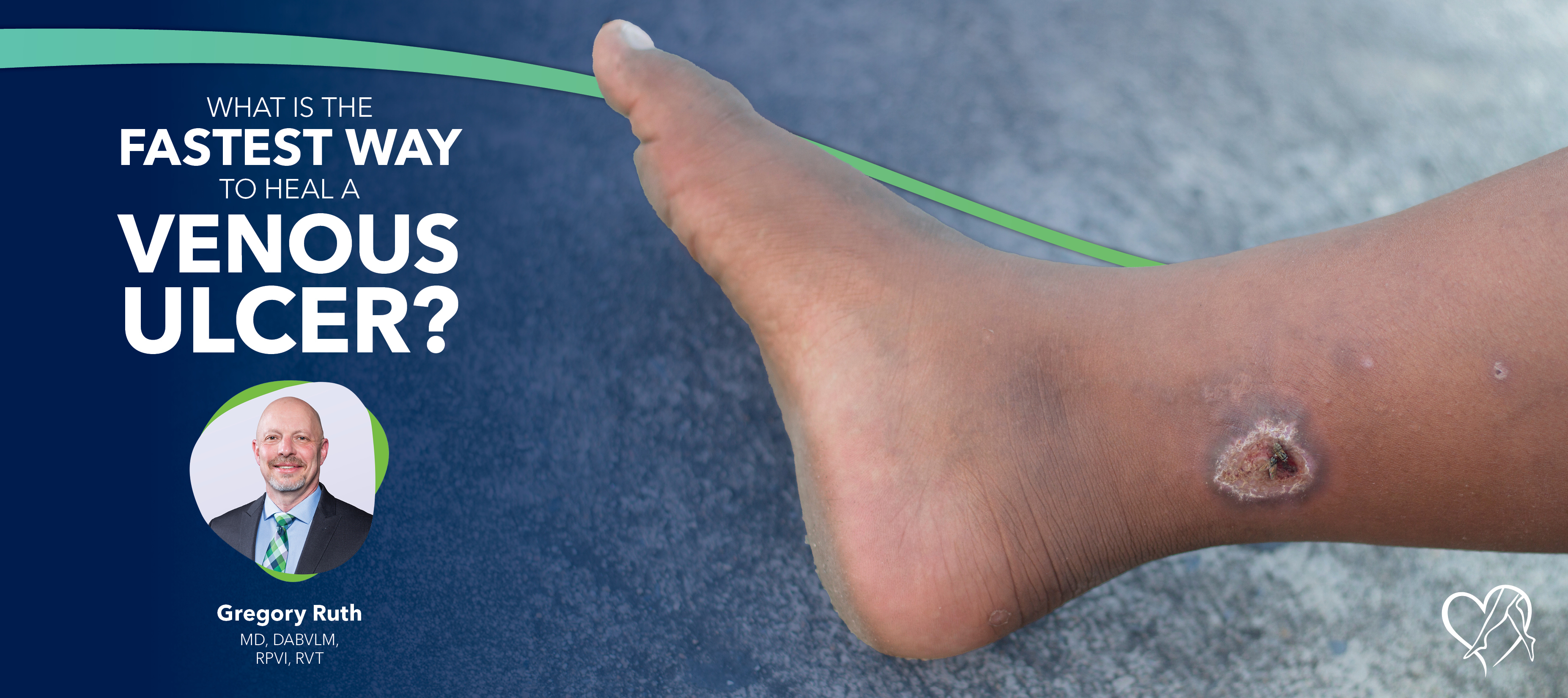 Blog Image What Is The Fastest Way To Heal Venous Ulcer