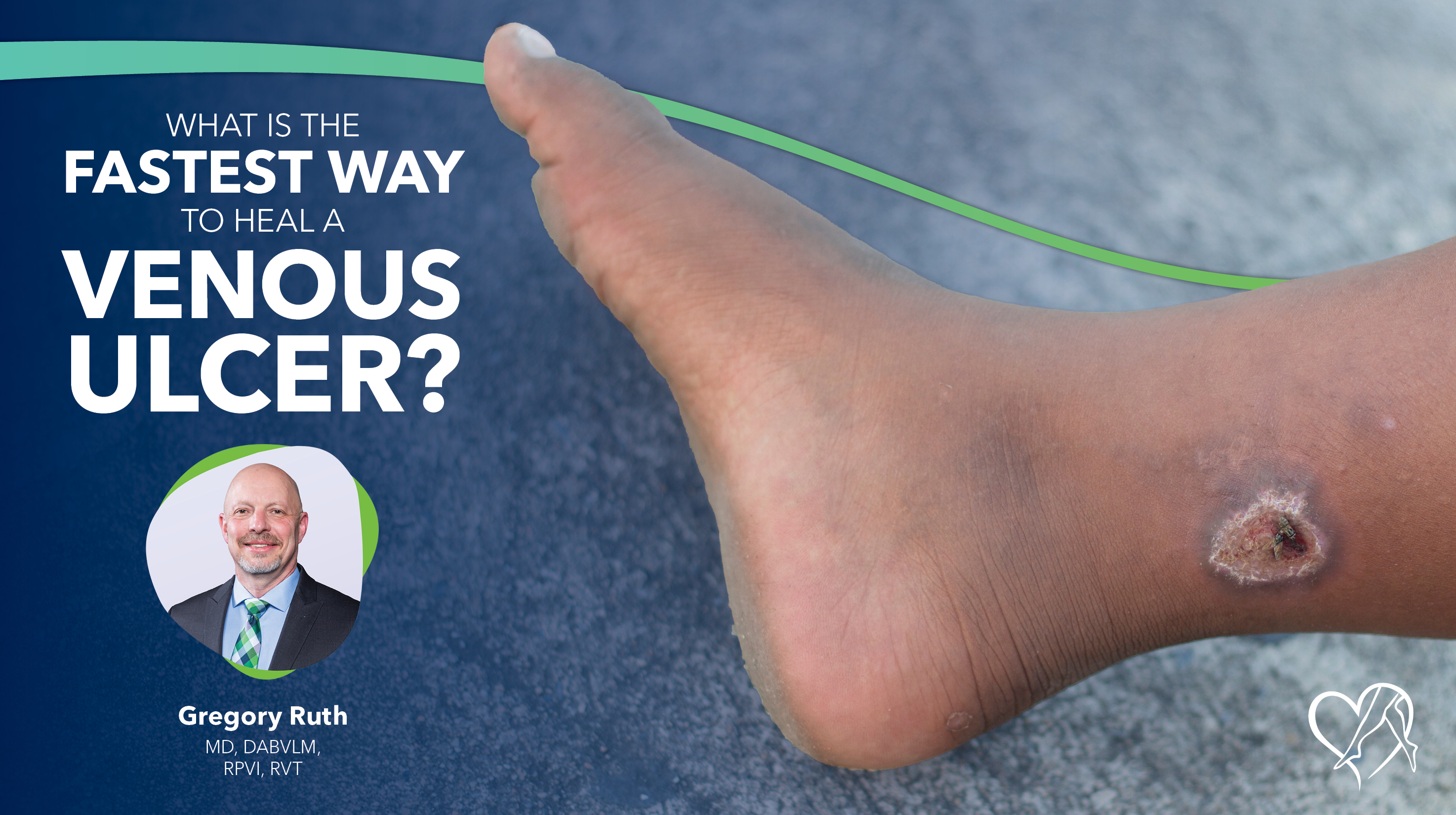 Blog Image What Is The Fastest Way To Heal Venous Ulcer Thumbnail
