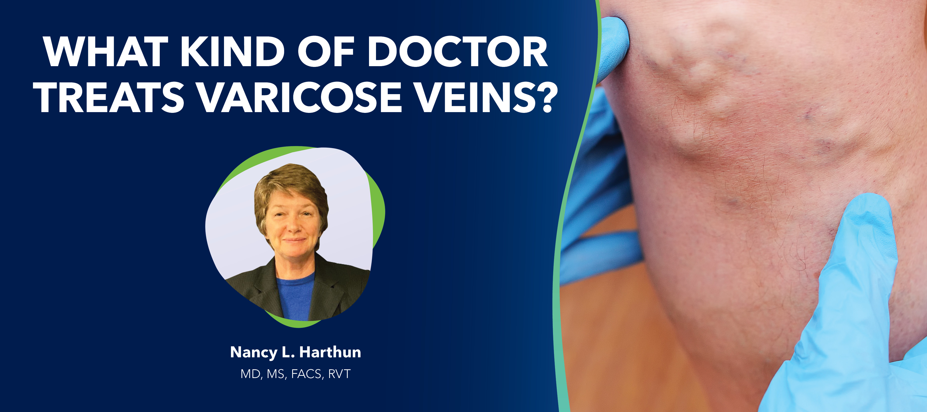 Blog Image What Kindof Doctor Treats Varicose Veins