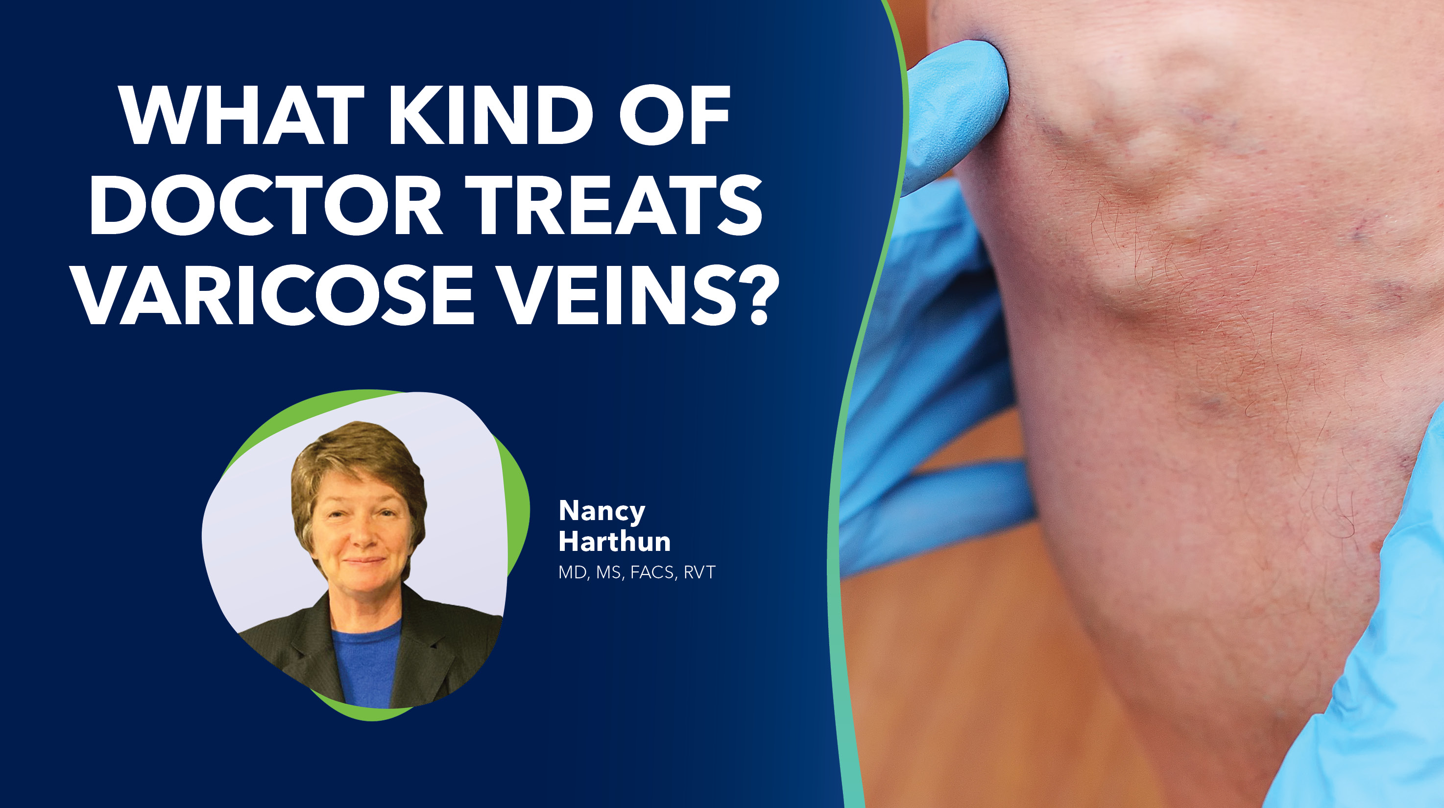 Blog Image What Kindof Doctor Treats Varicose Veins Thumbnail