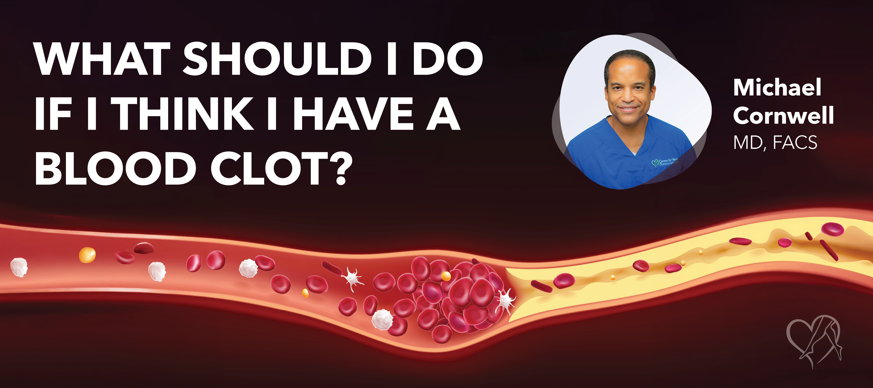 Blog Image What Should I Do If I Think I Havea Blood Clot