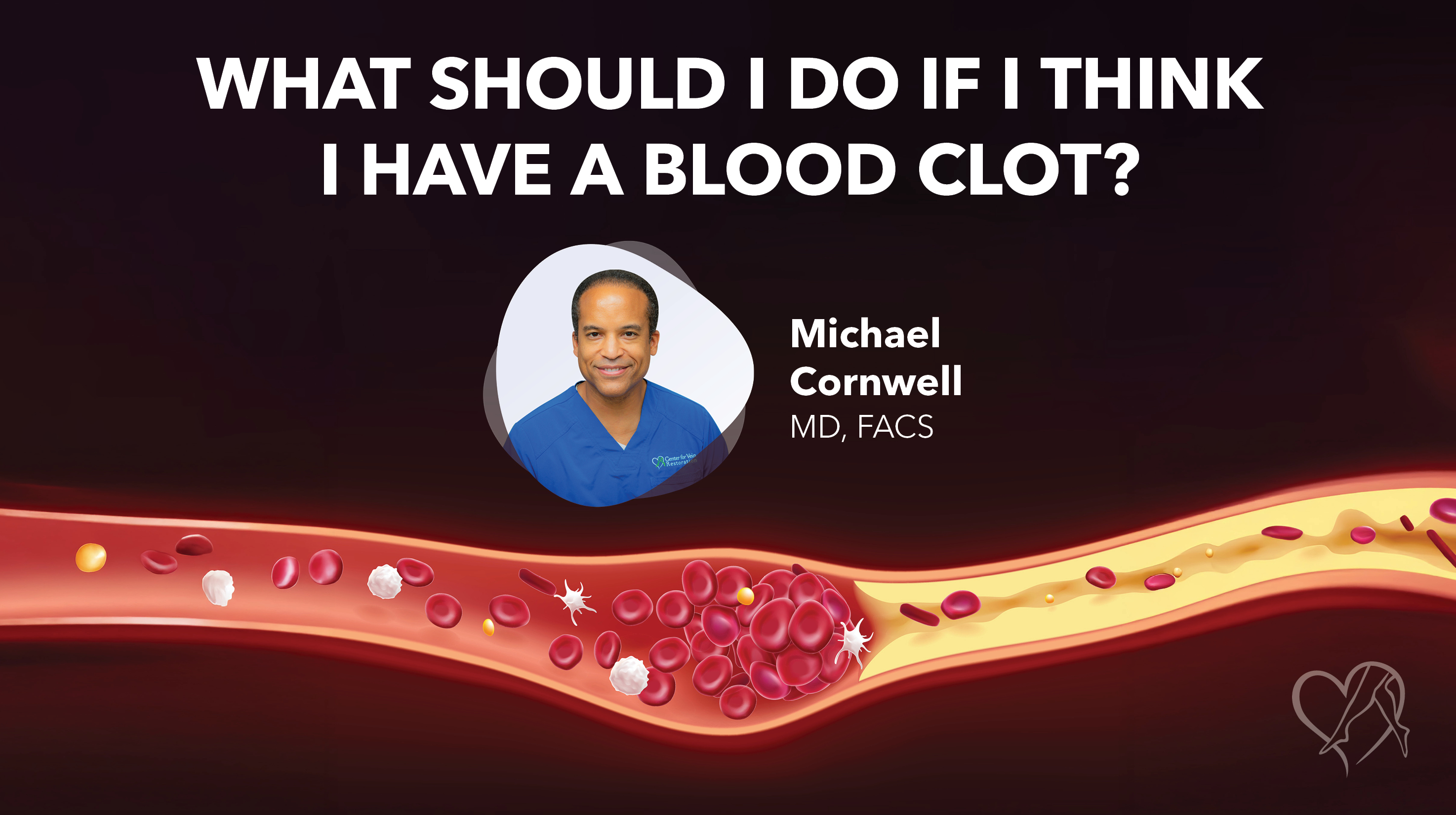Blog Image What Should I Do If I Think I Havea Blood Clot Thumbnail