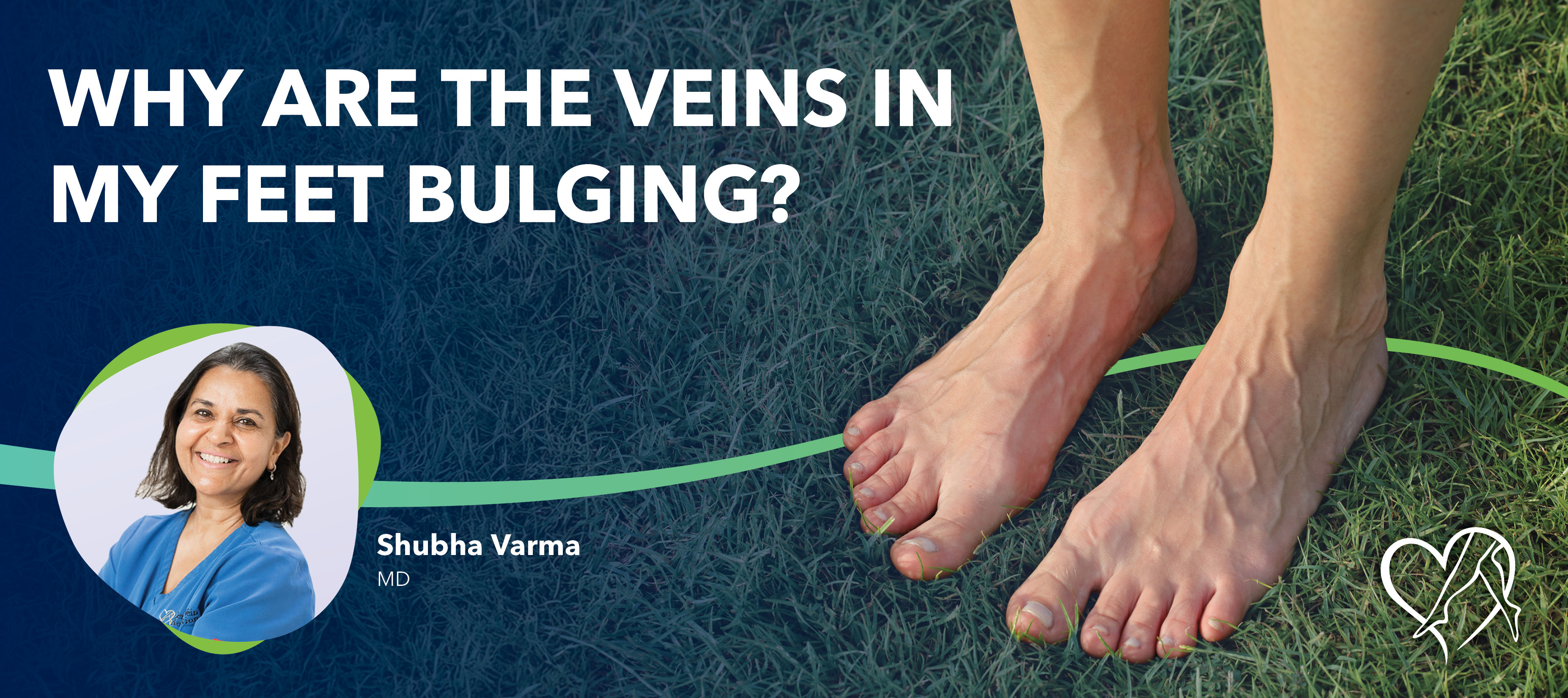 Blog Image Why Are The Veins In My Feet Bulging