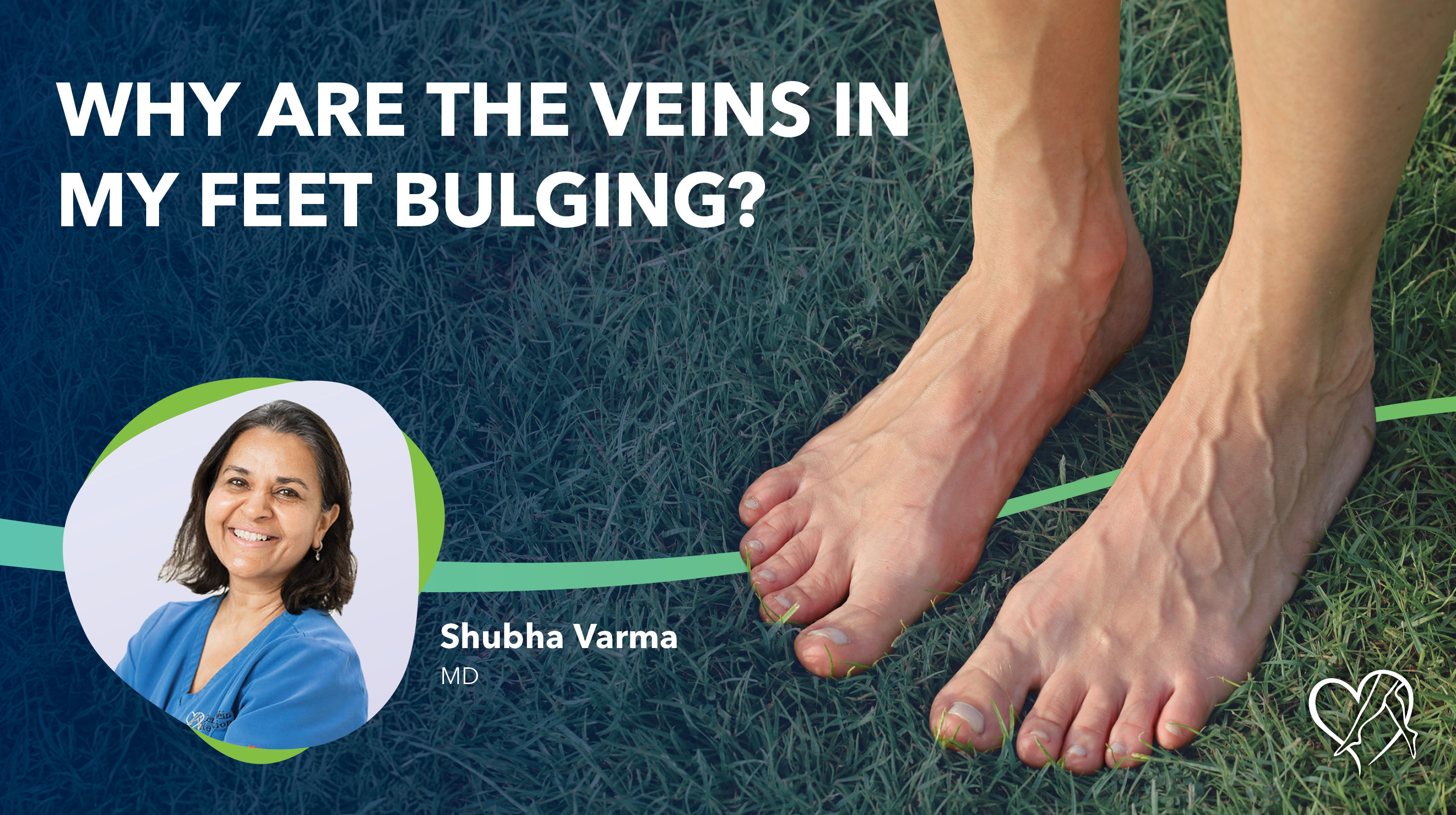 Blog Image Why Are The Veins In My Feet Bulging Thumbnail