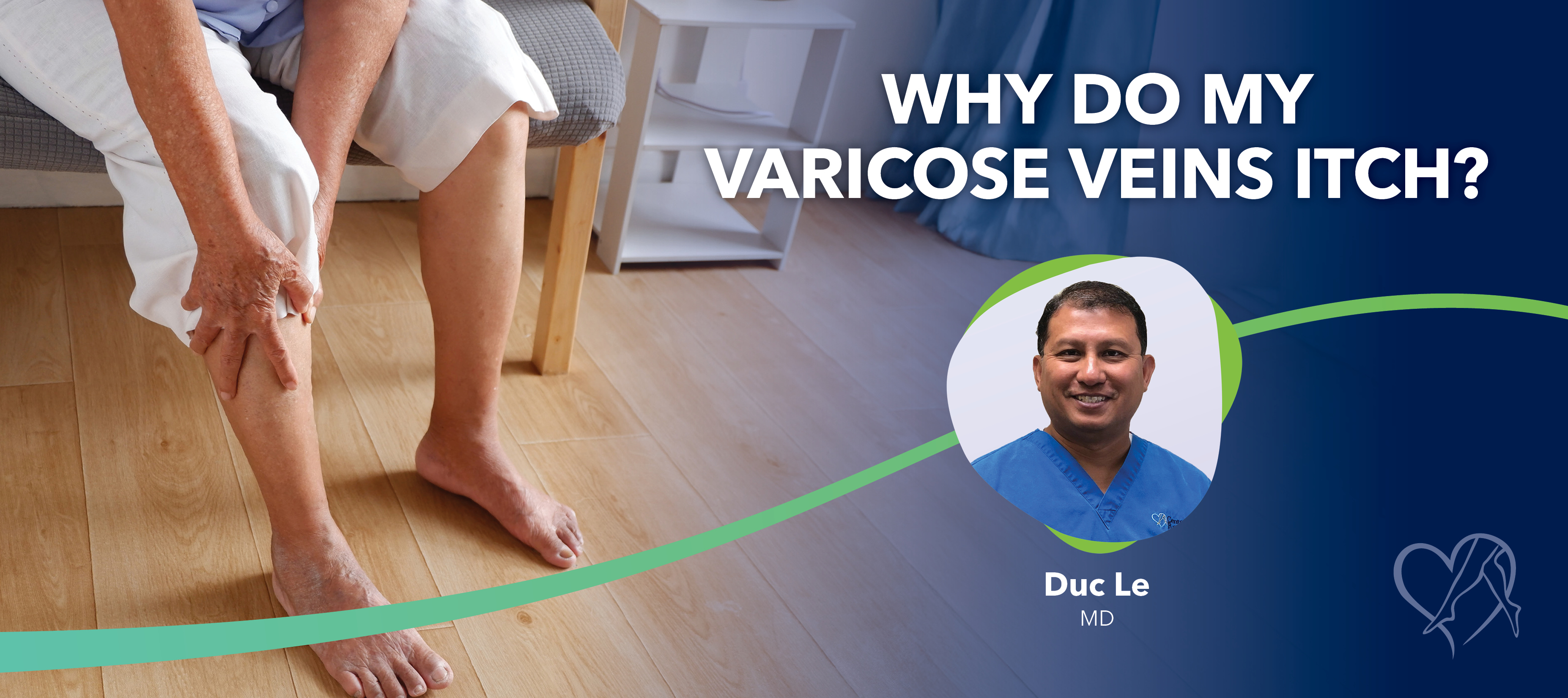 Blog Image Why Do My Varicose Veins Itch