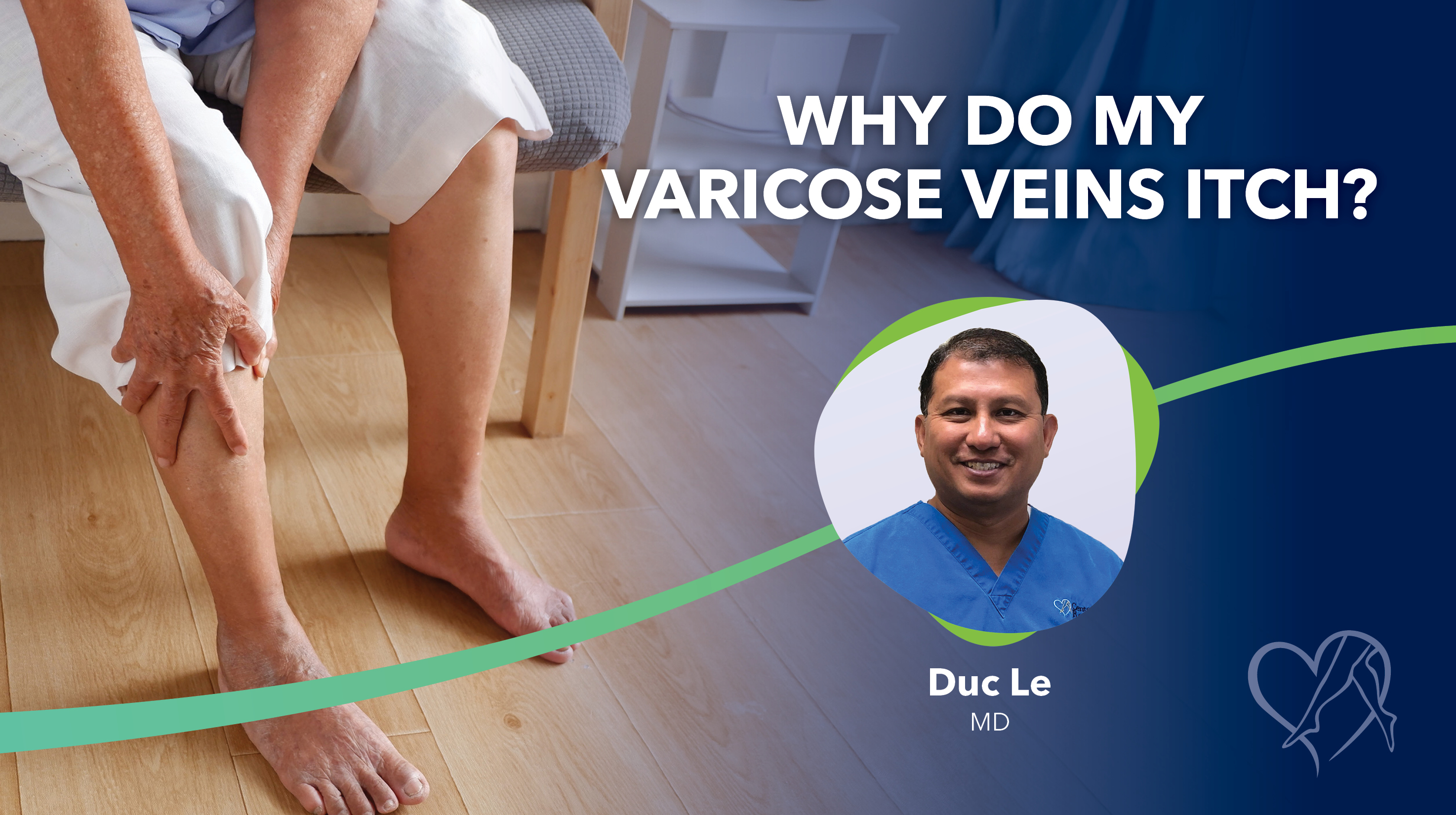 Blog Image Why Do My Varicose Veins Itch Thumbnail