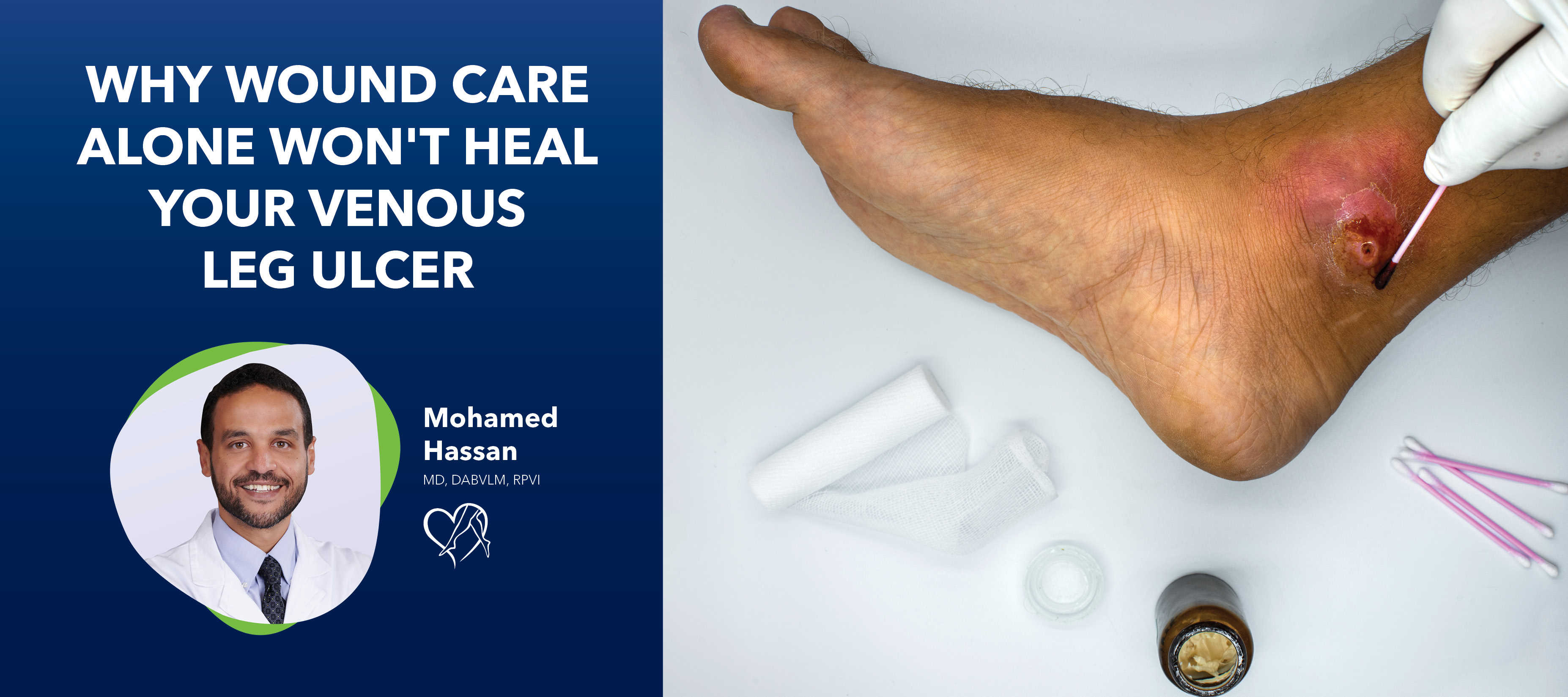 Blog Image Why Wound Care Alone