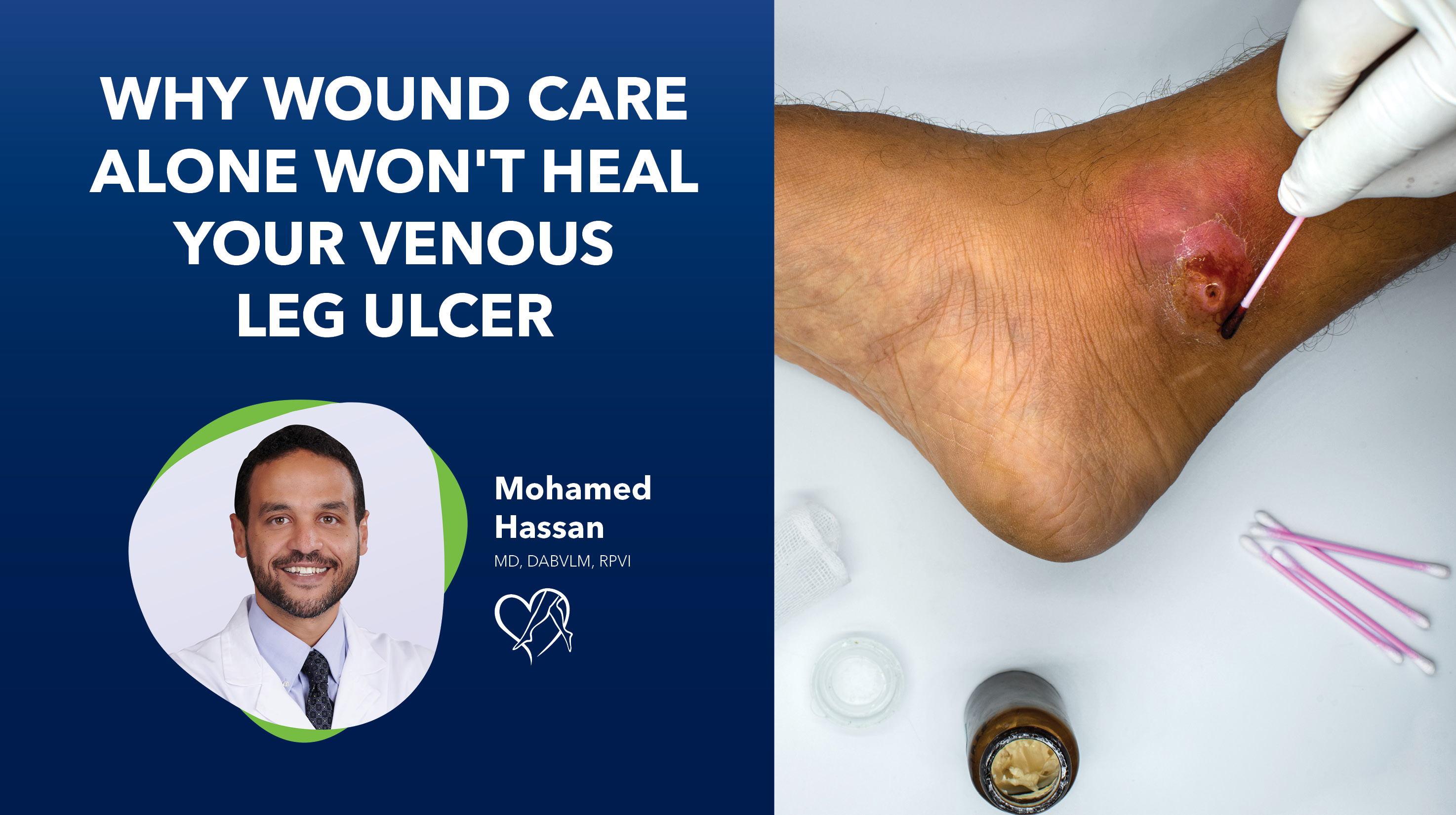 Blog Image Why Wound Care Alone Thumbnail