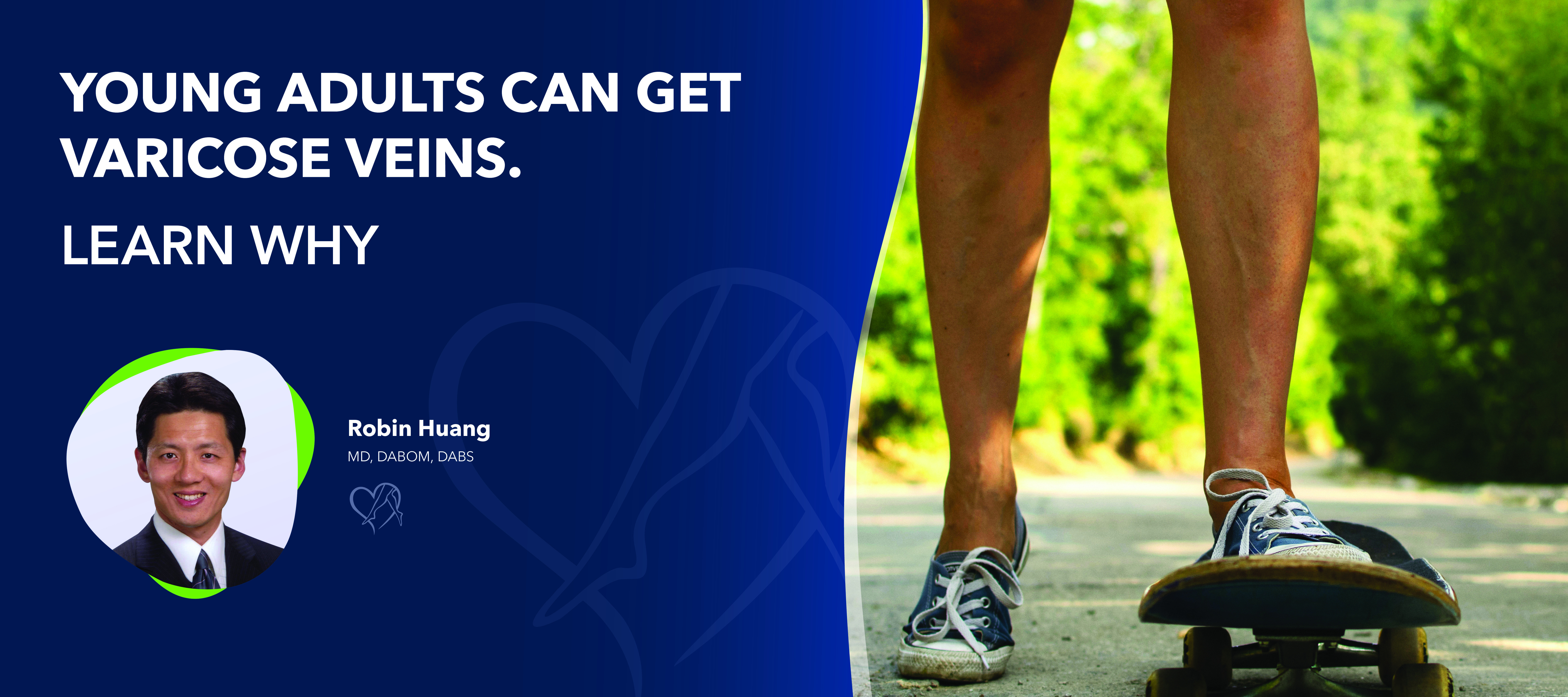Blog Image Young Adults Can Get Varicose Veins