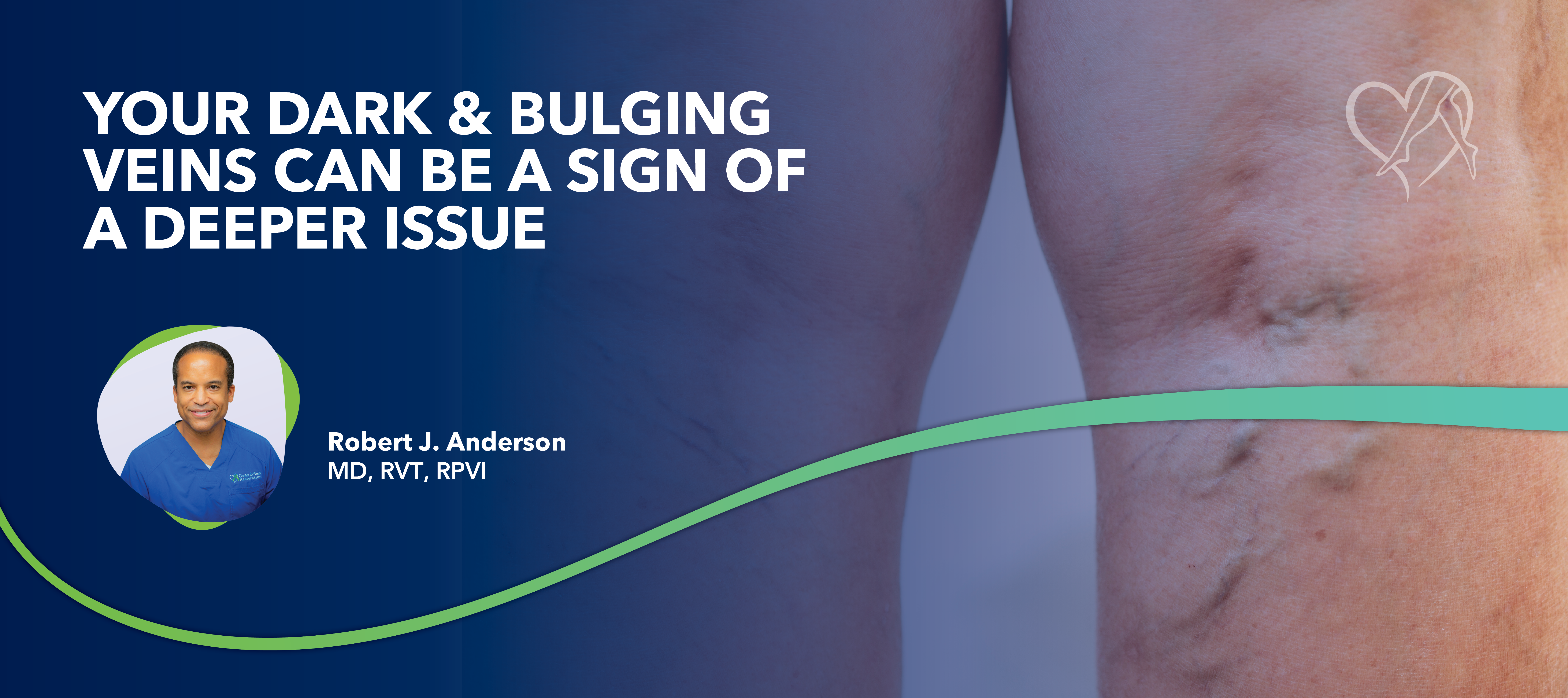 Your Dark & Bulging Veins Can Be a Sign of a Deeper Issue