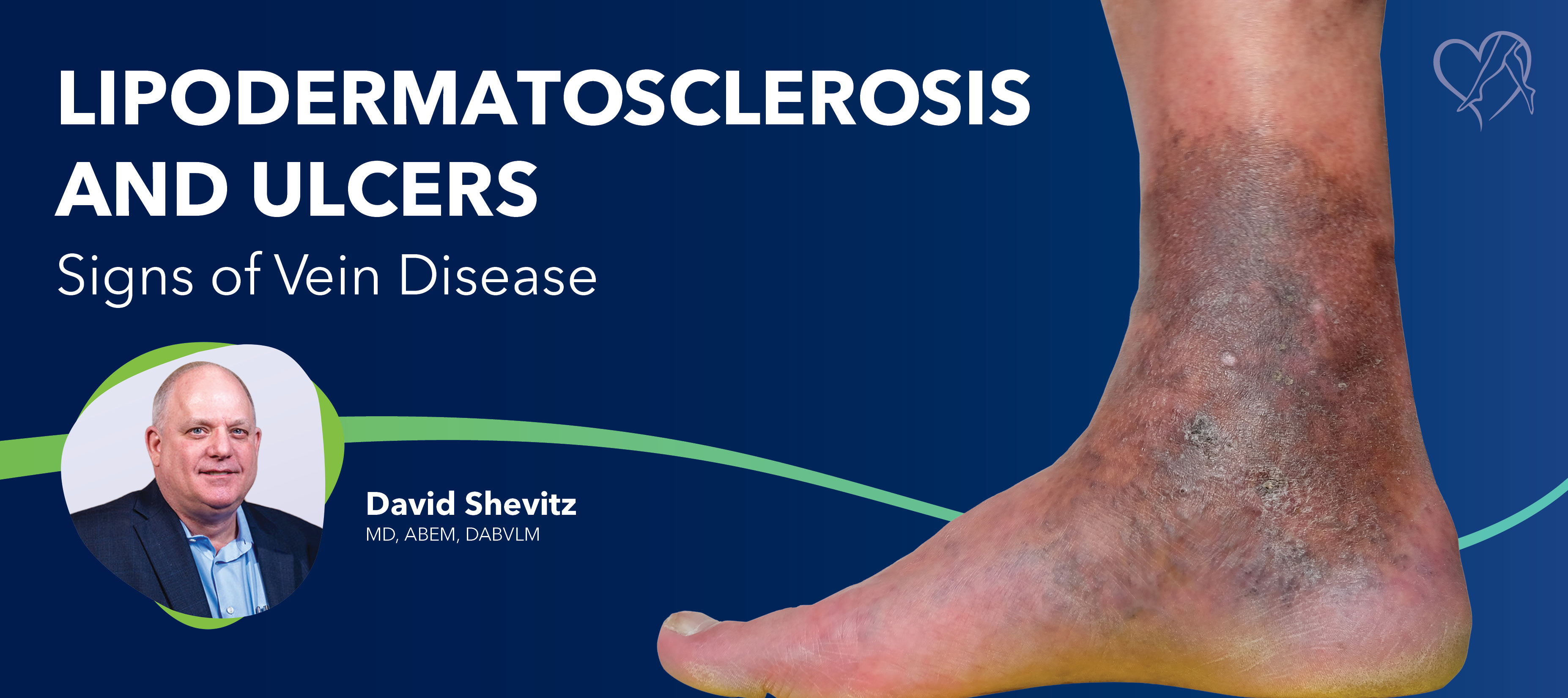Blog Image lipodermatosclerosis and Ulcers