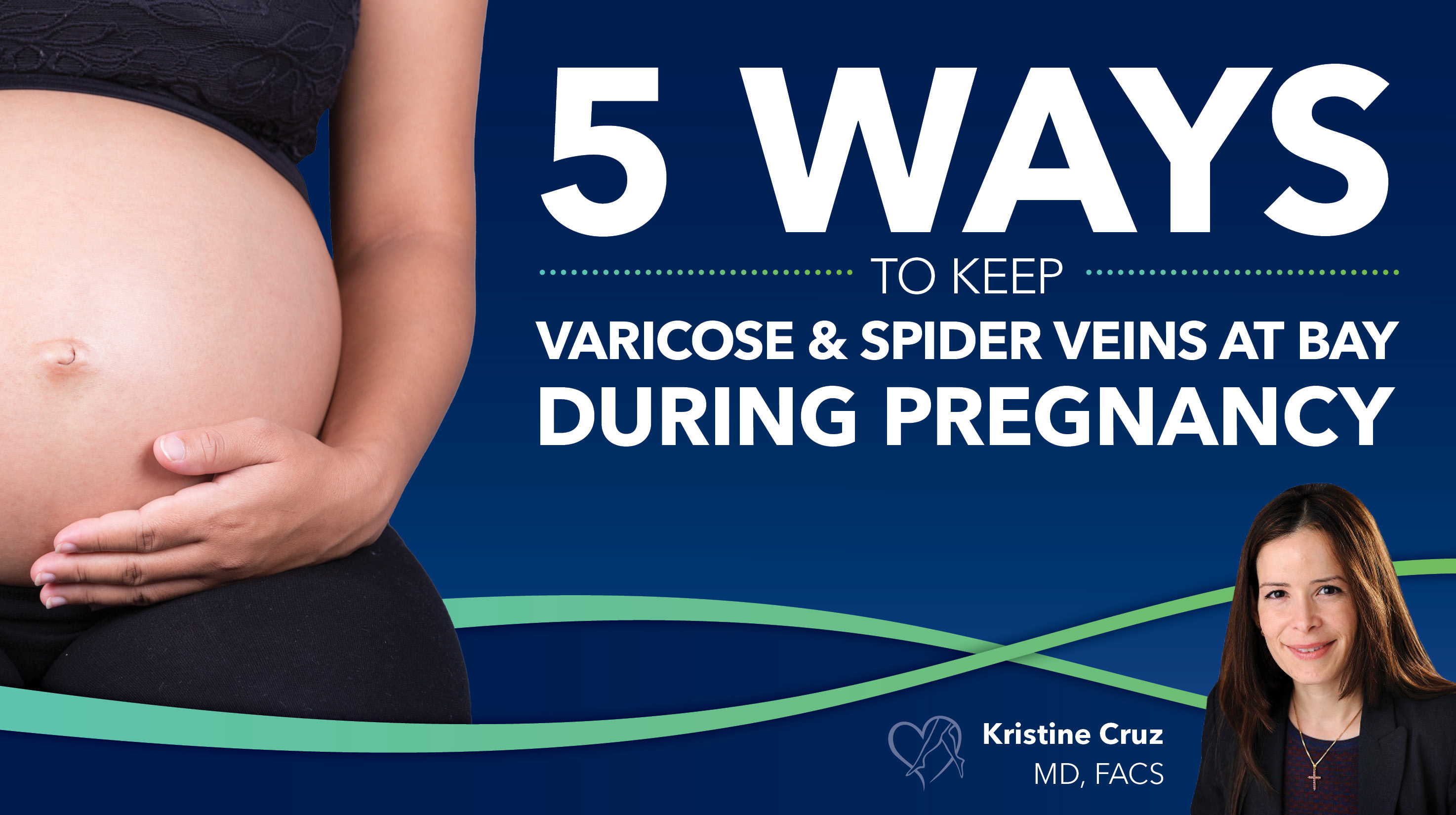 Blog 5 Ways to Keep Varicose and Spider Veins at Bay During Pregnancy Thumbnail