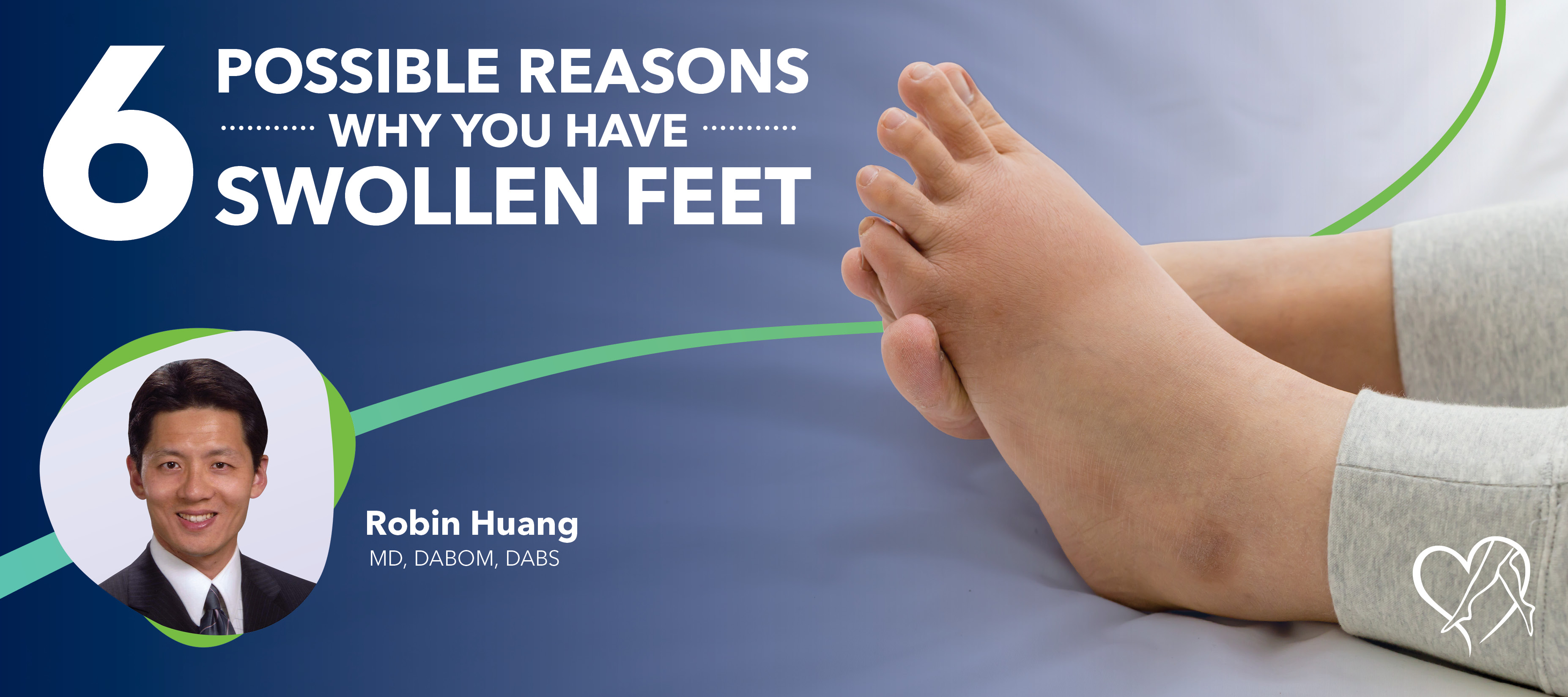 Blog 6 Possible Reasons Why You Have Swollen Feet