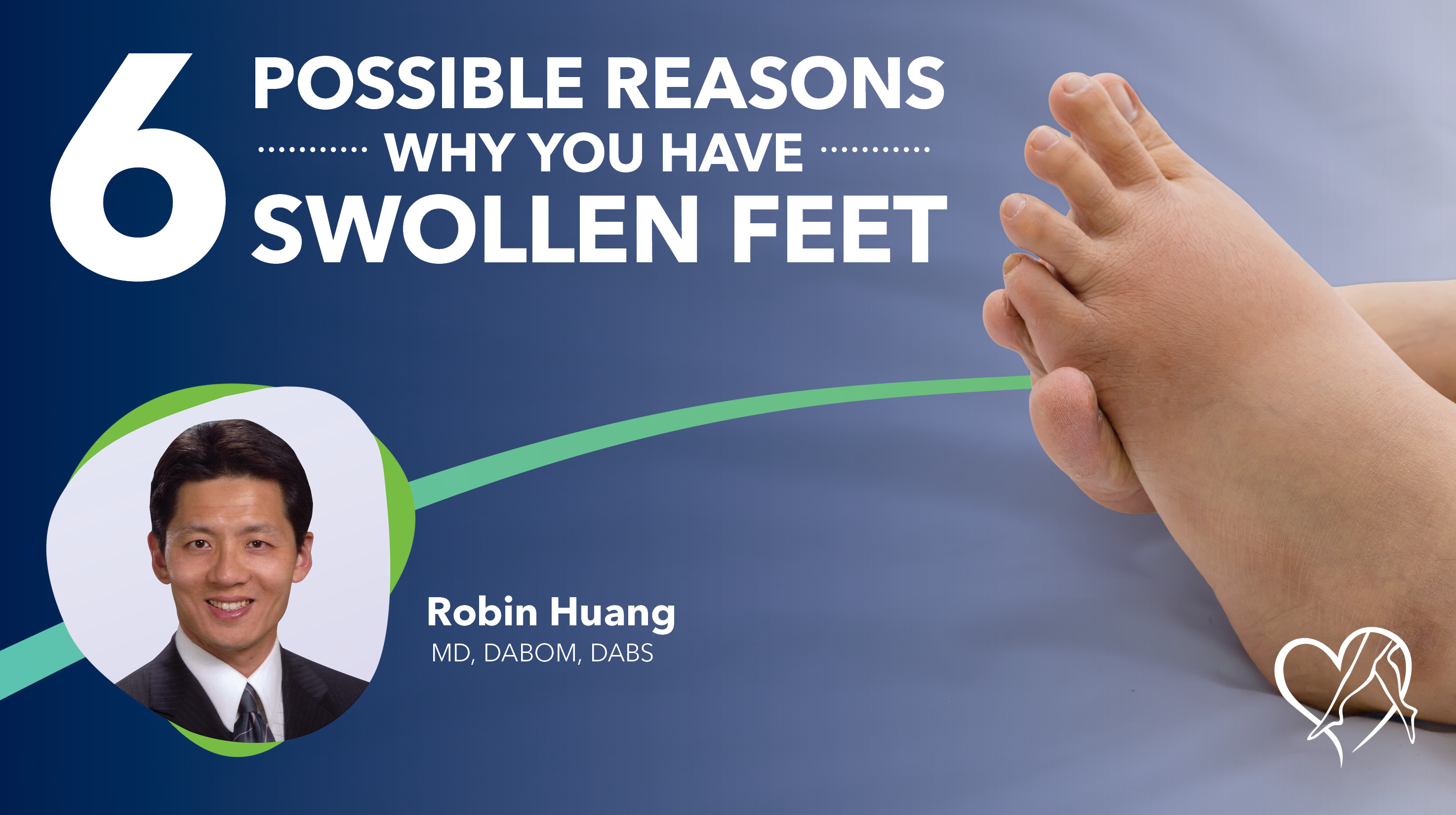 Blog 6 Possible Reasons Why You Have Swollen Feet Thumbnail