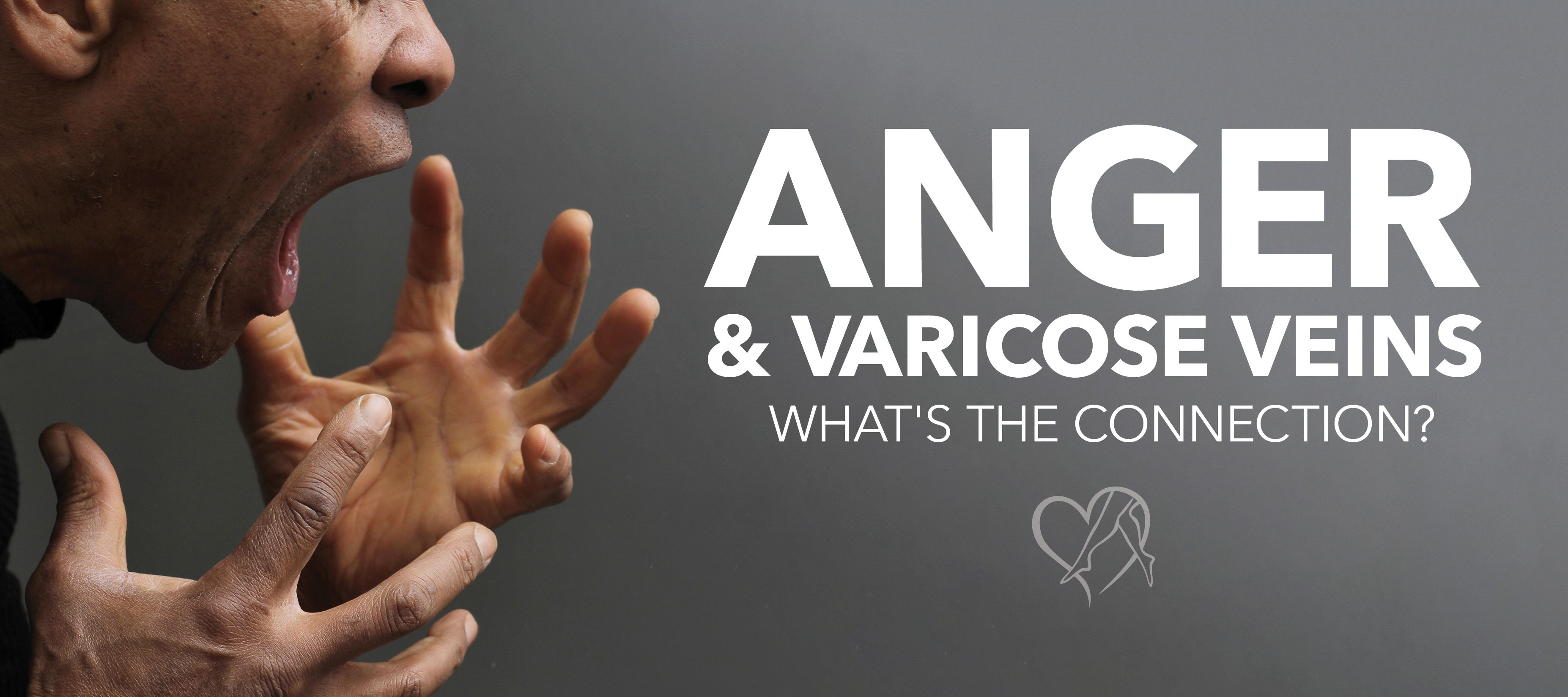 Blog Anger Varicose Veins