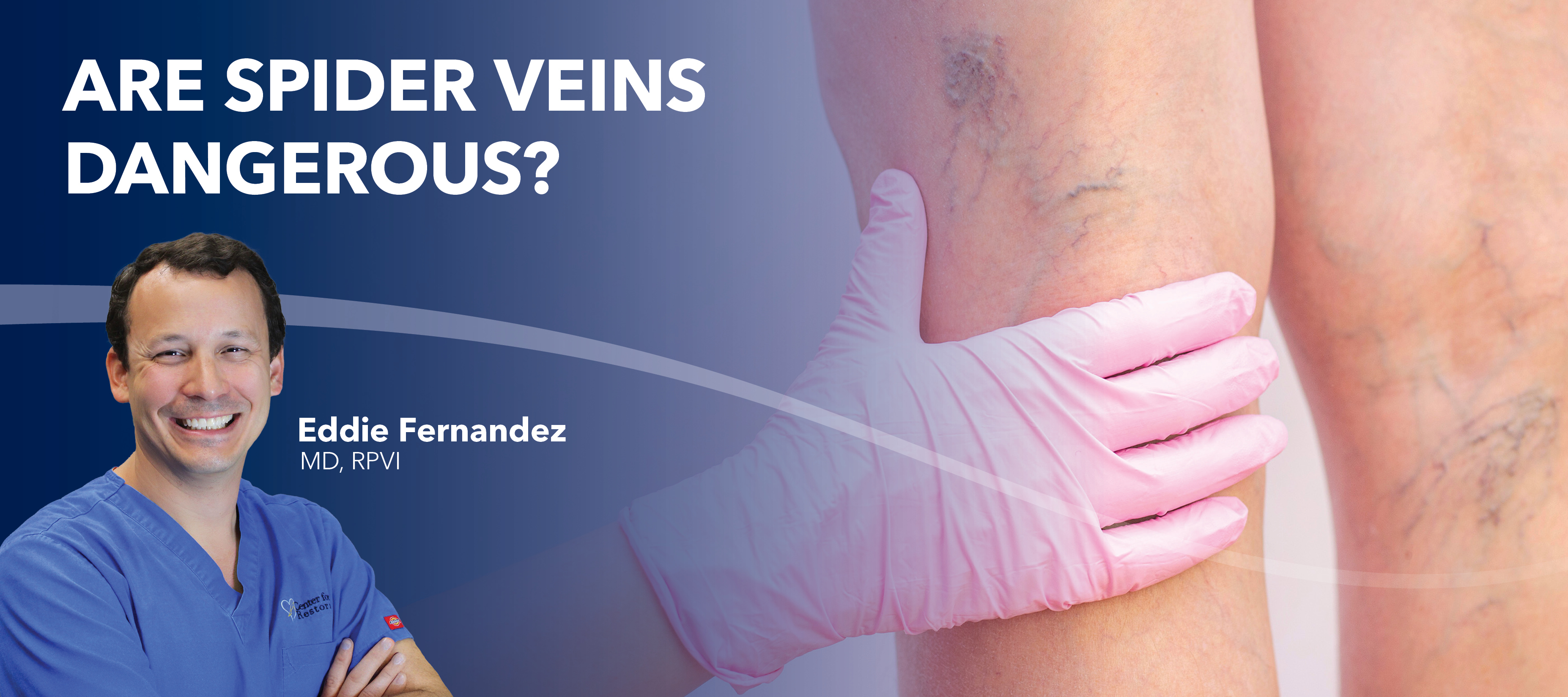 Blog Are Spider Veins Dangerous