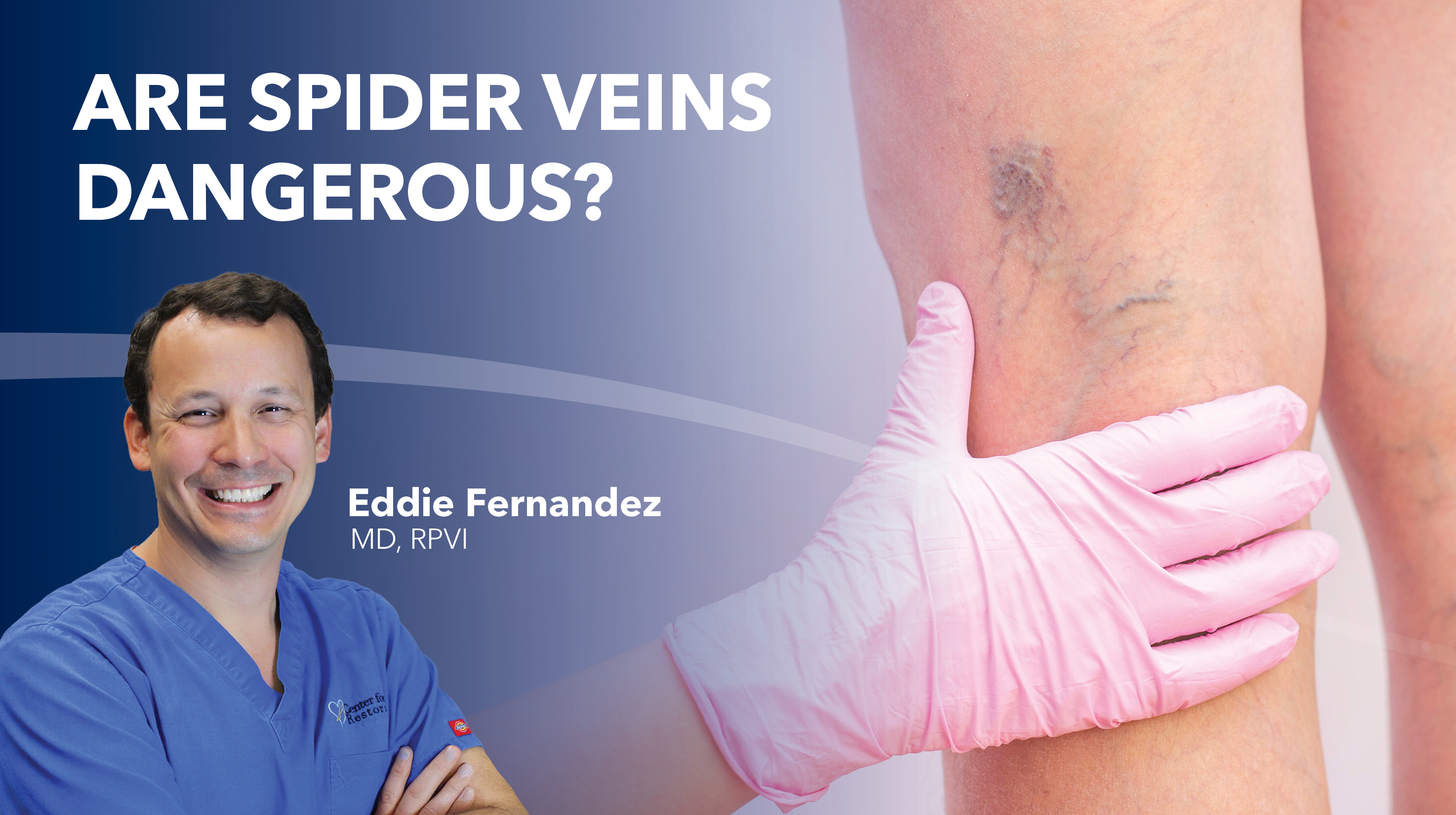 Blog Are Spider Veins Dangerous Thumbnail