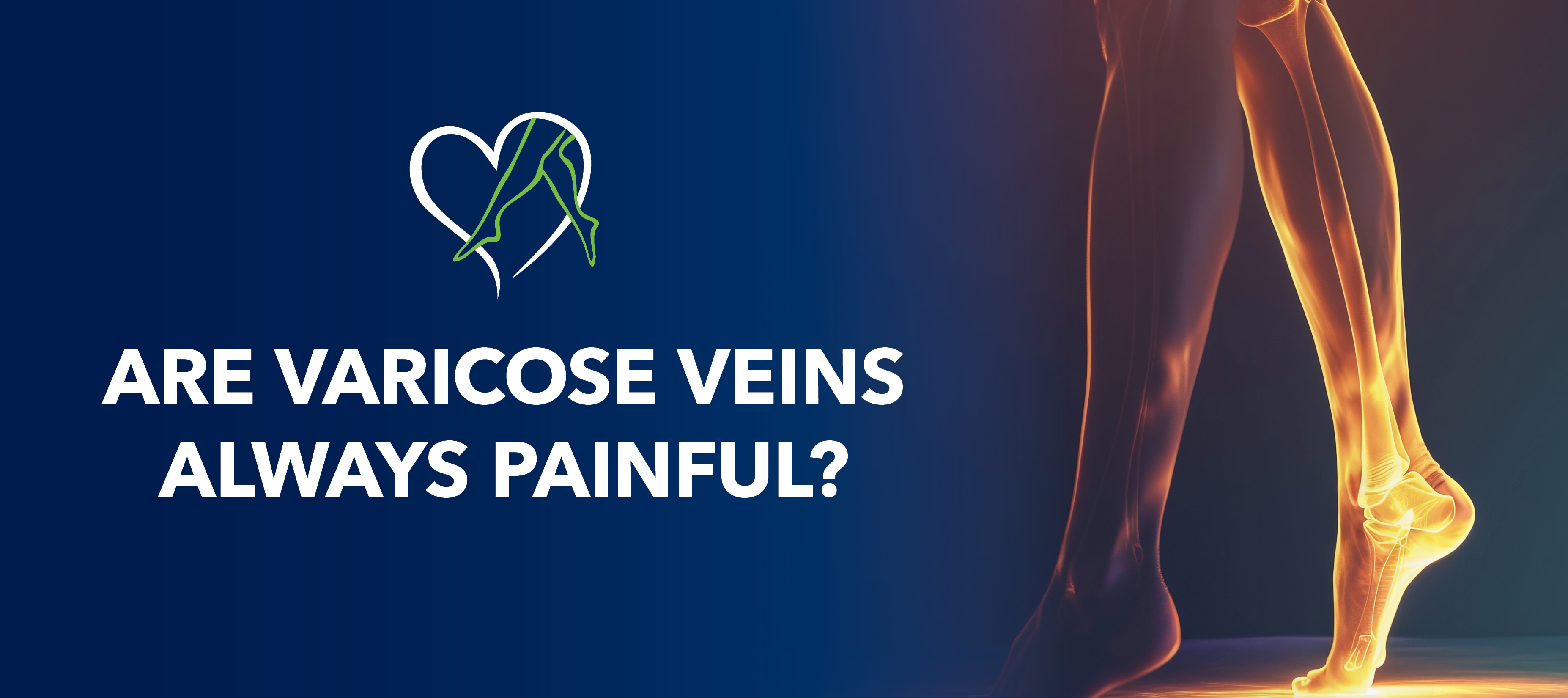 Blog Are Varicose Veins Always Painful