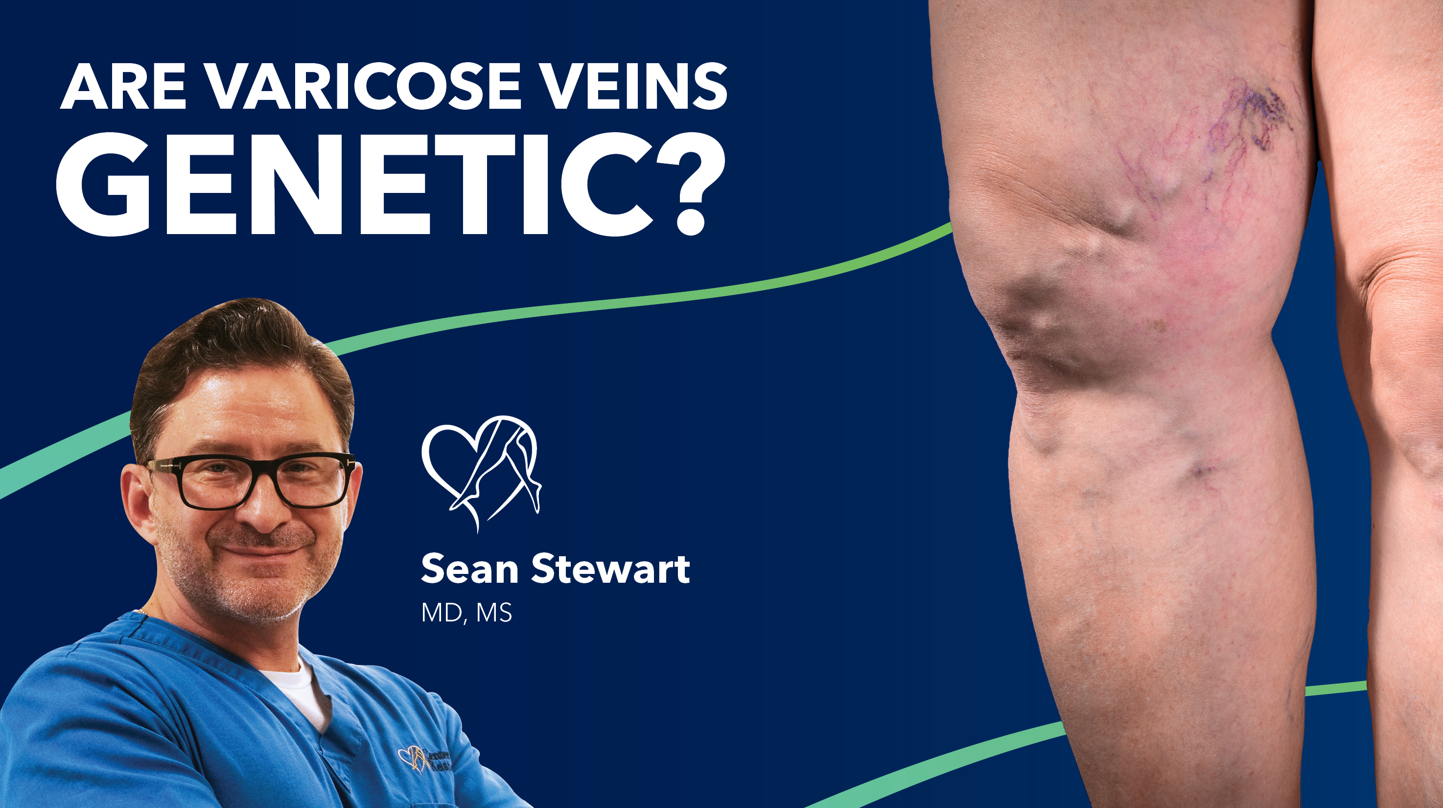 Blog Are Varicose Veins Genetic Thumbnail