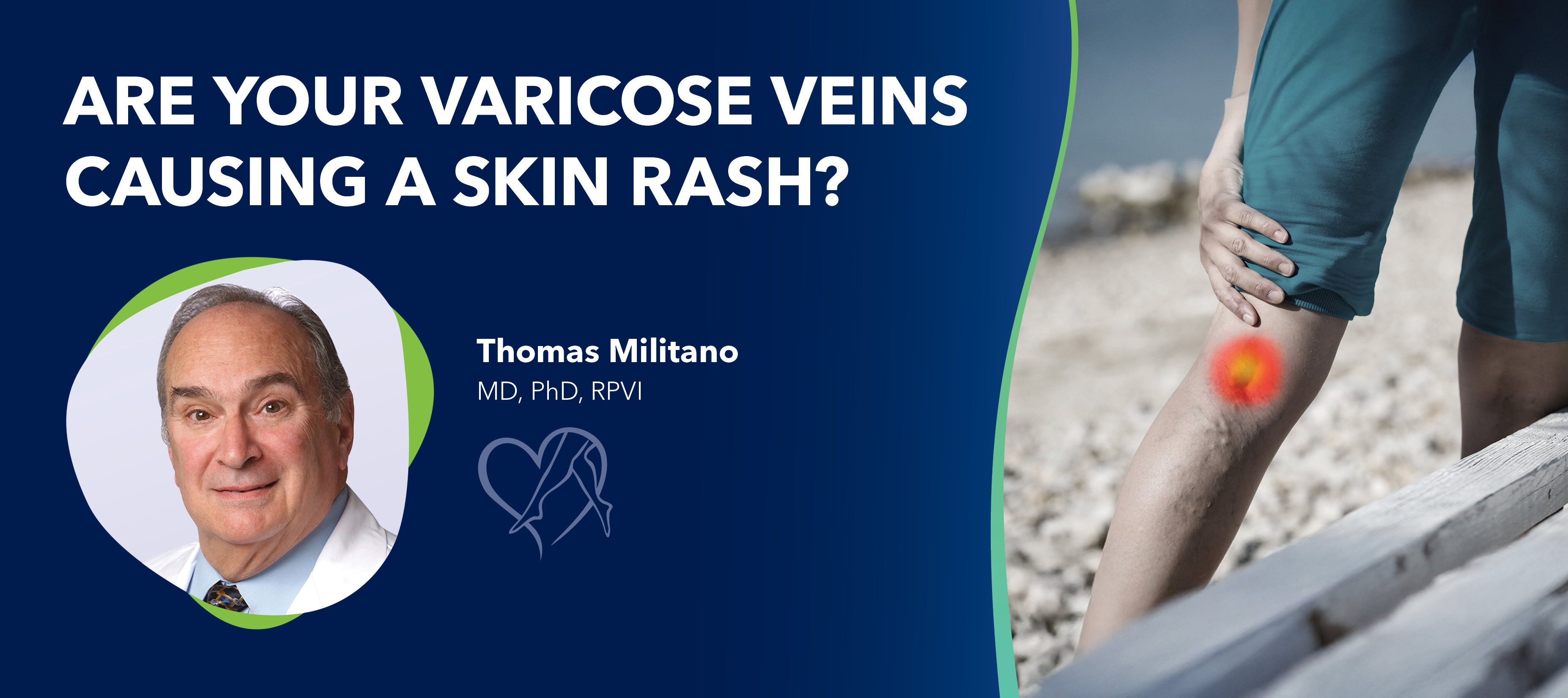 Blog Are Your Varicose Veins Causinga Skin Rash