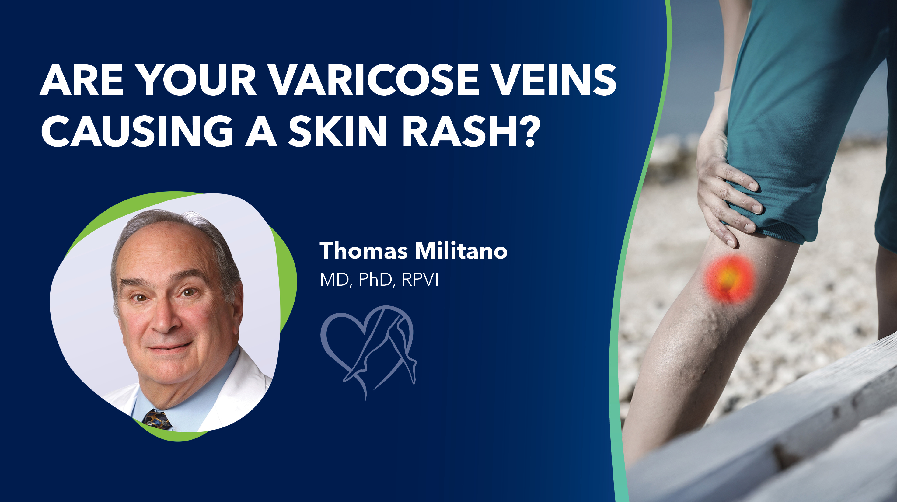 Blog Are Your Varicose Veins Causinga Skin Rash Thumbnail