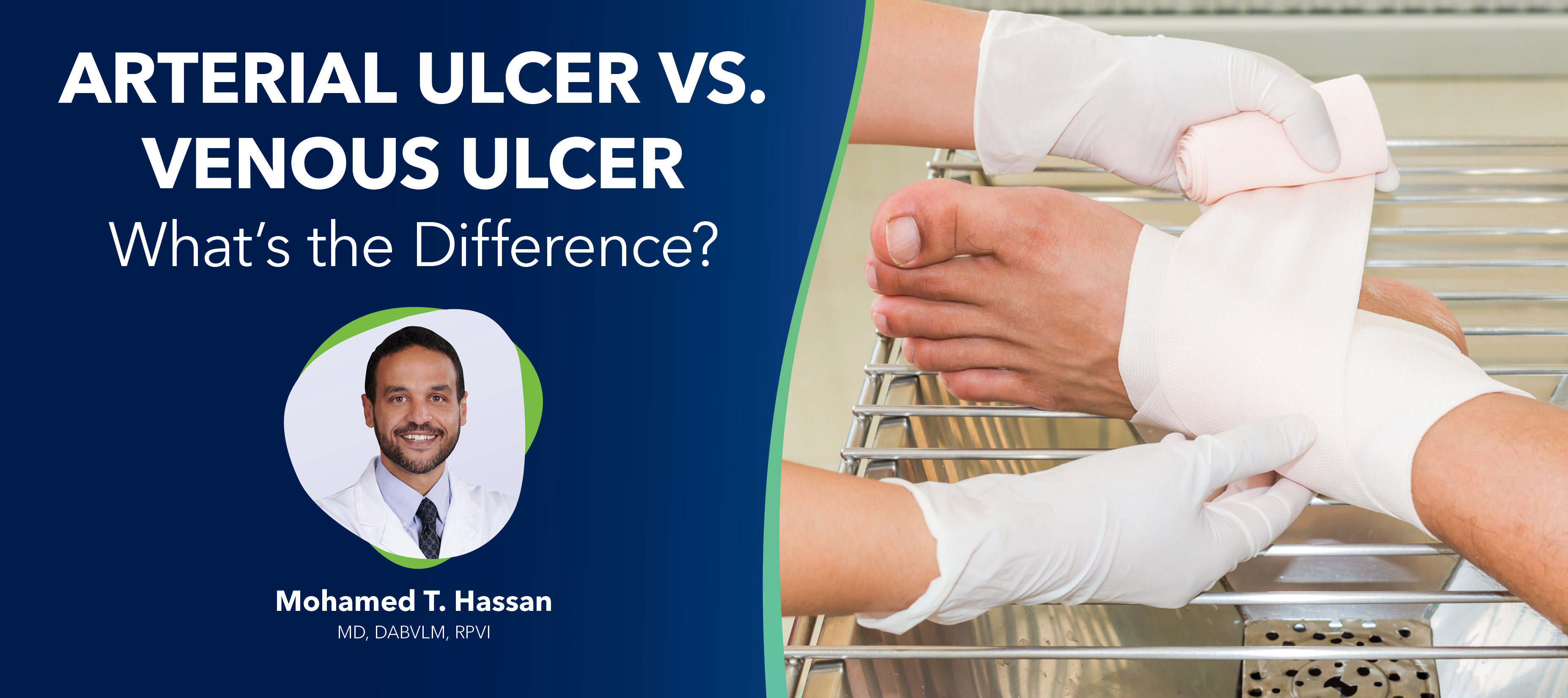Blog Arterial Ulcer Vs Venous Ulcer