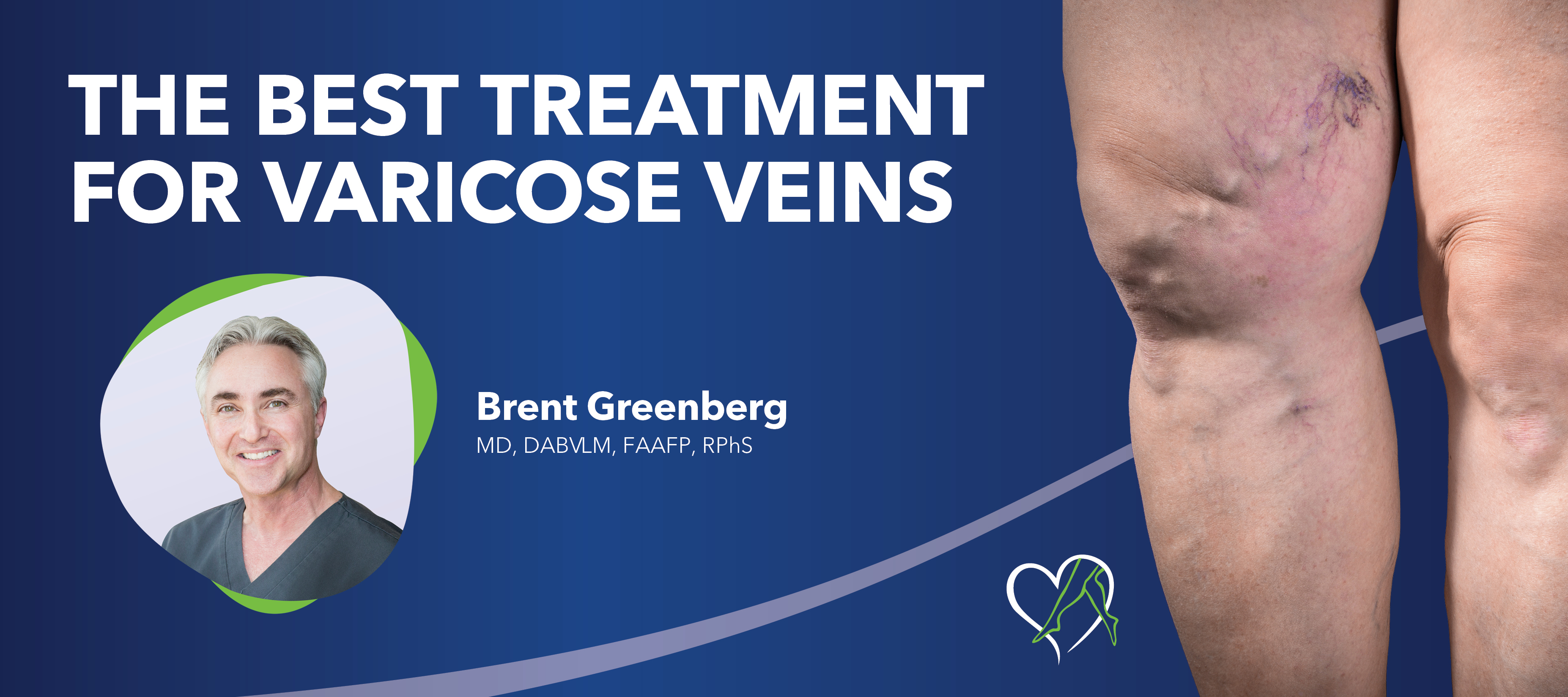 Blog Best Treatmentfor Varicose Veins