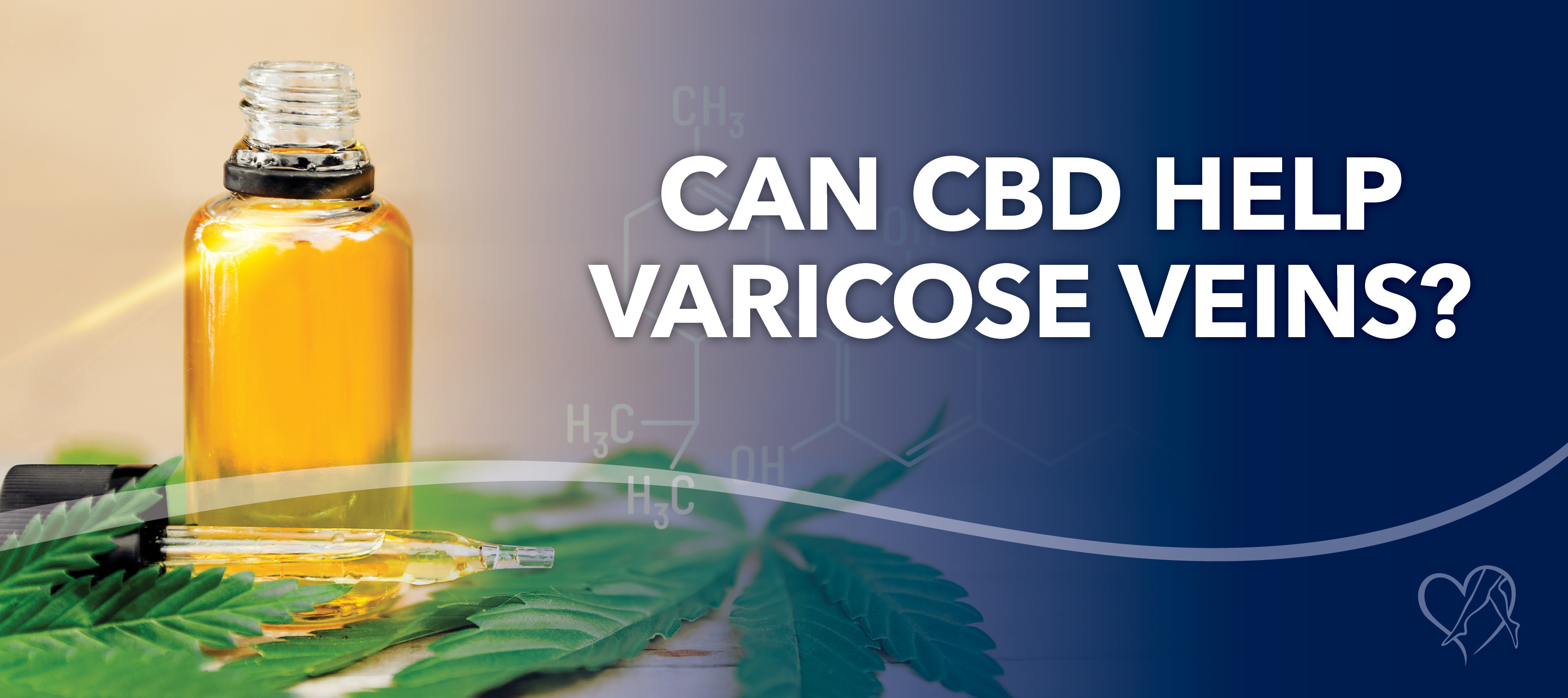 Blog Can CBD Help Varicose Veins
