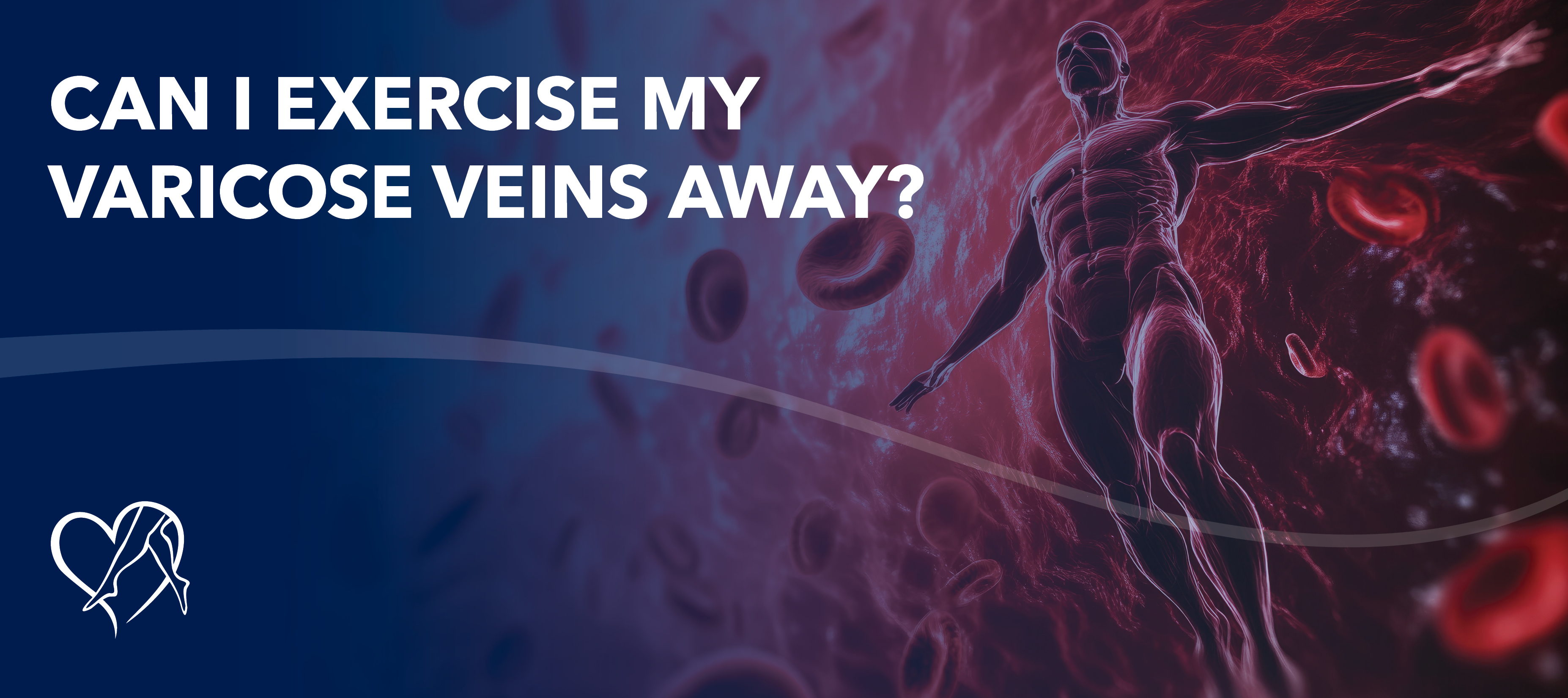 Blog Can I Exercise My Varicose Veins Away