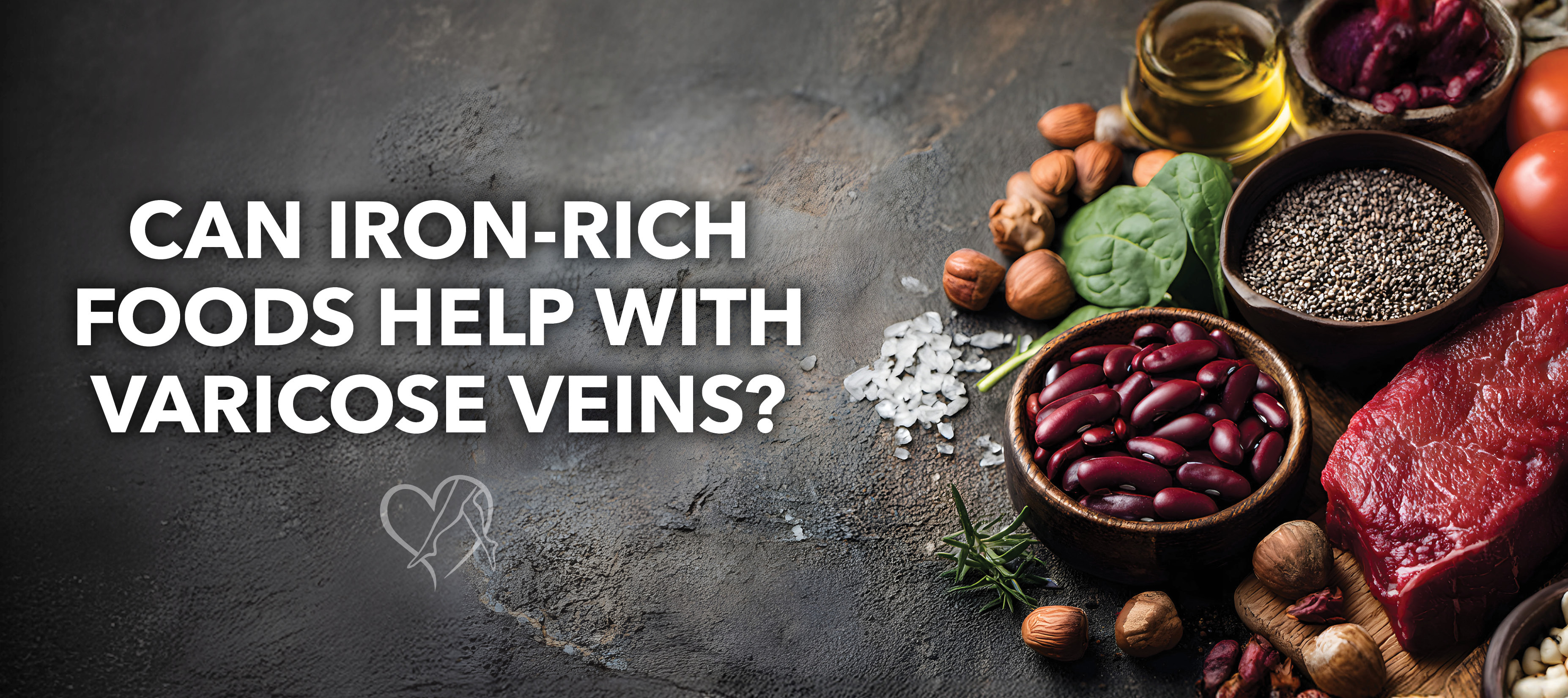 Blog Can Iron Rich Foods Help With Varicose Veins