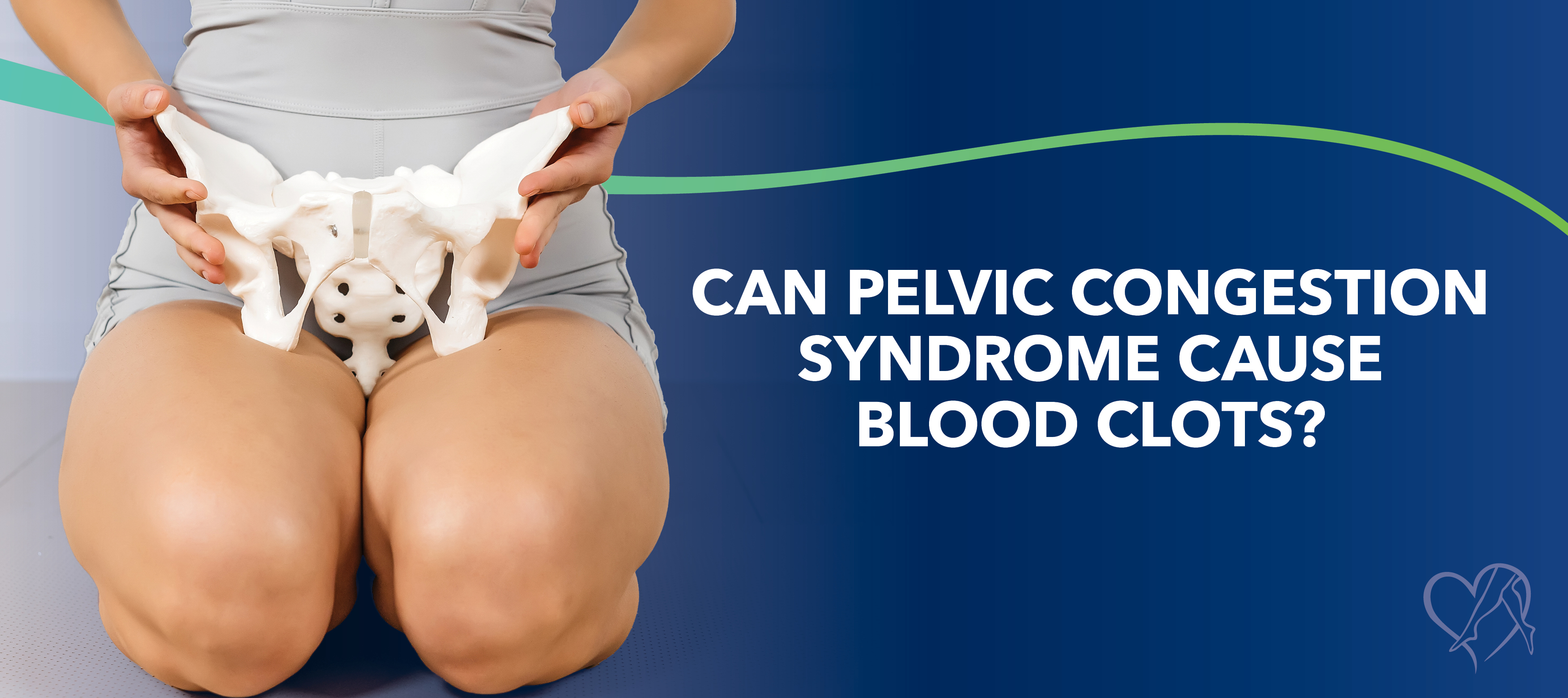 Blog Can Pelvic Congestion Syndrome Cause Blood Clots