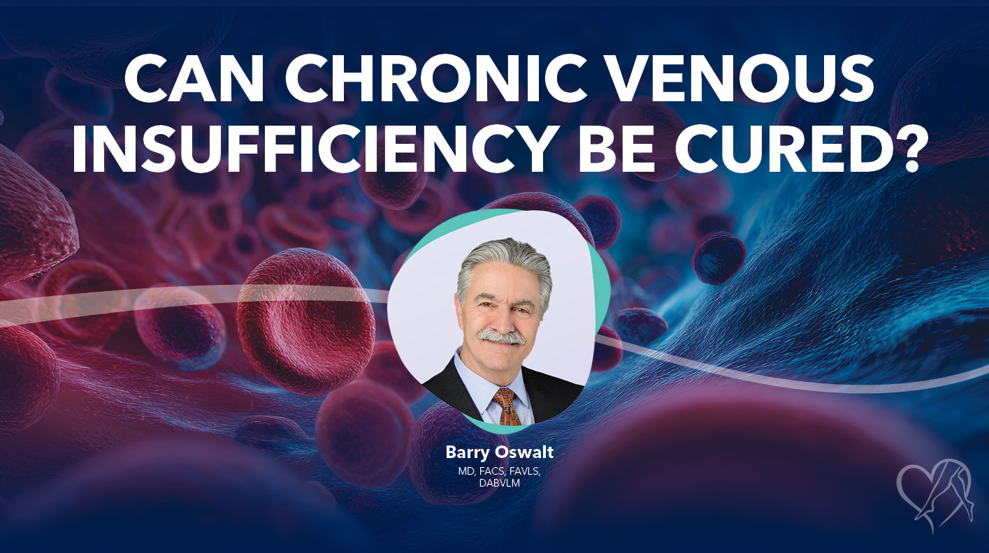 Blog Can Venous Insufficiency Be Cured Thumbnail