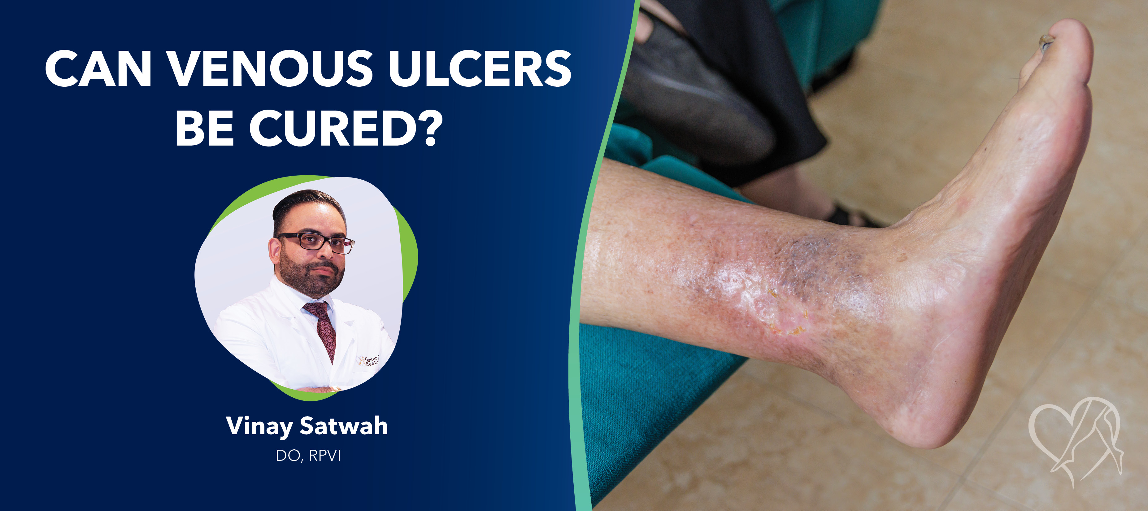 Blog Can Venous Ulcers Be Cured