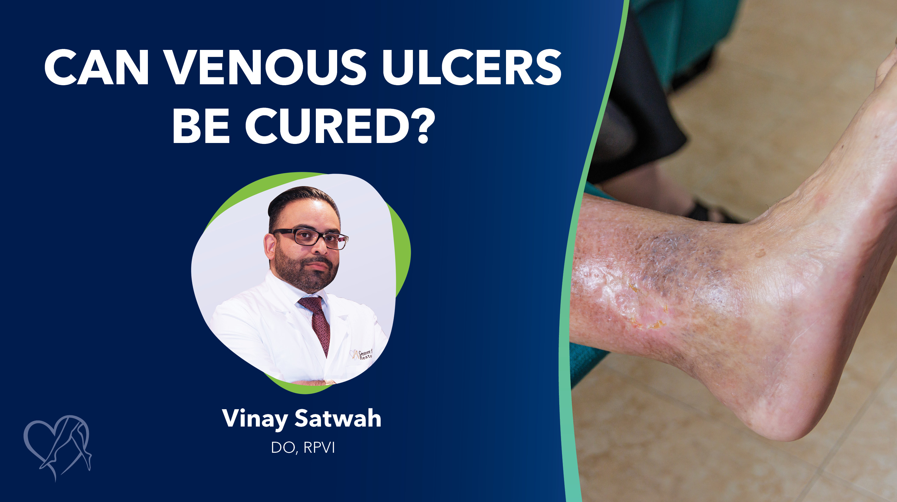Blog Can Venous Ulcers Be Cured Thumbnail