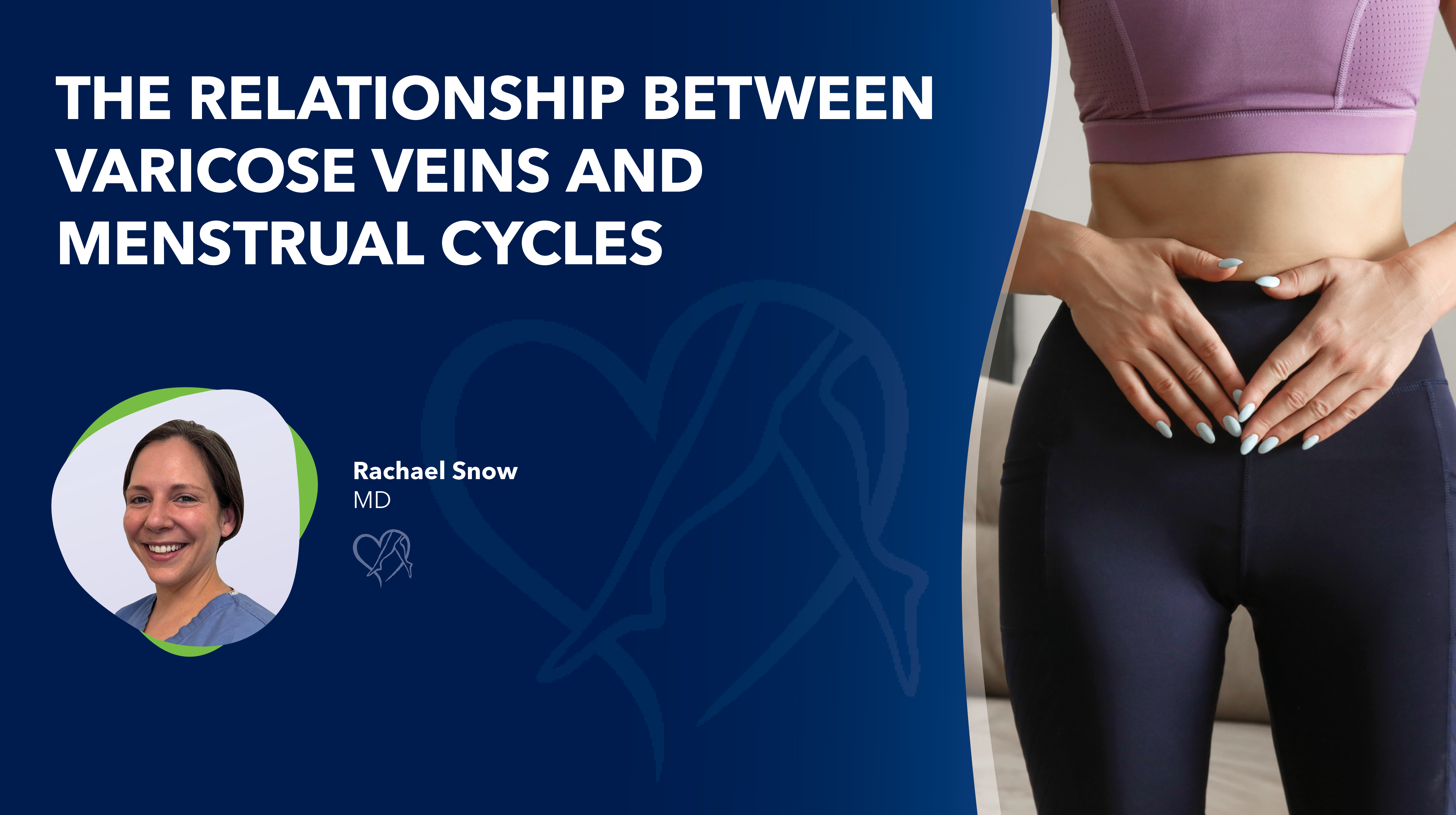 Blog Do Varicose Veins Cause Itching thumbnail 1