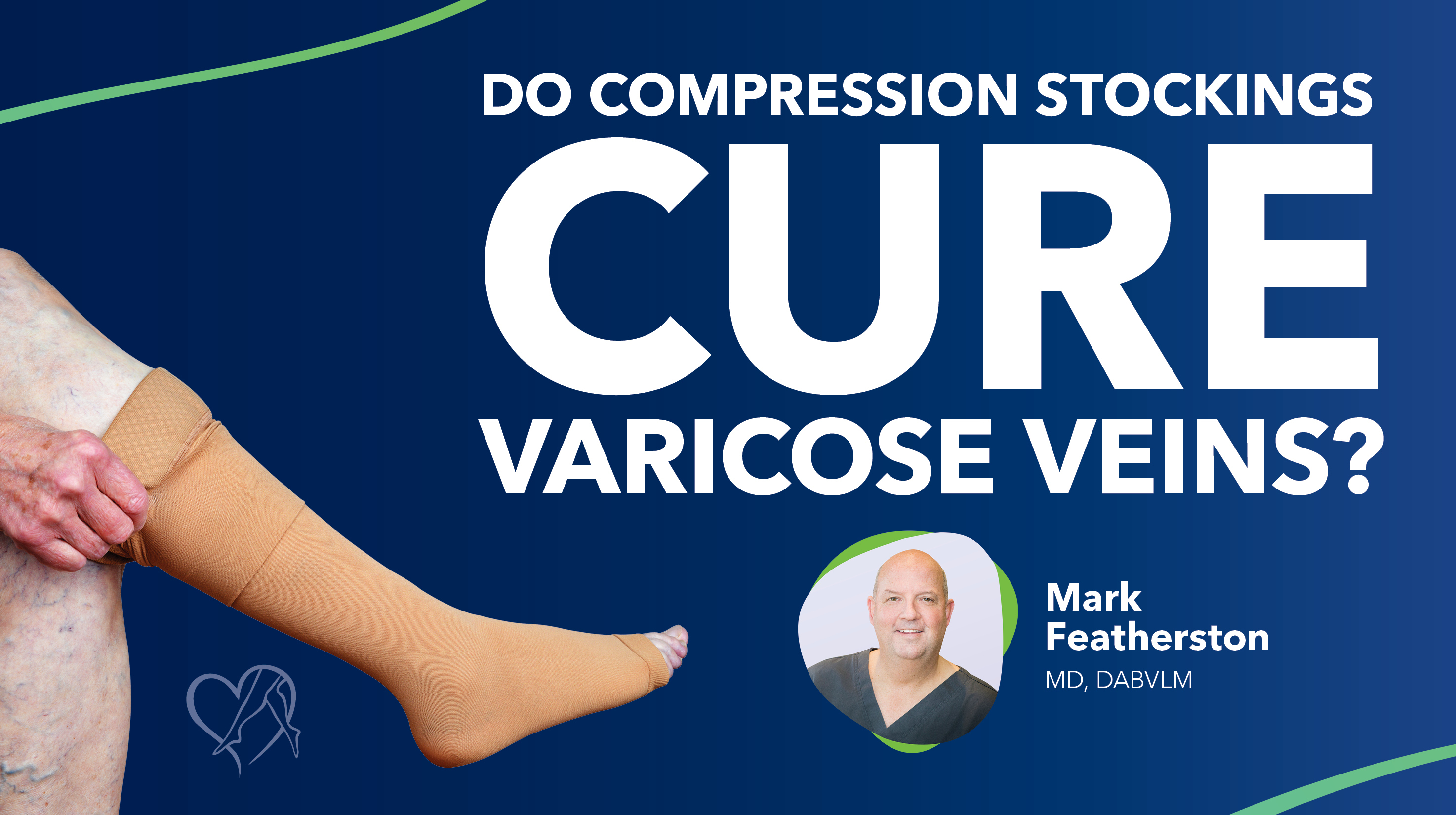 Blog Do Compression Stockings Cure Varicose Veins Thumbnail