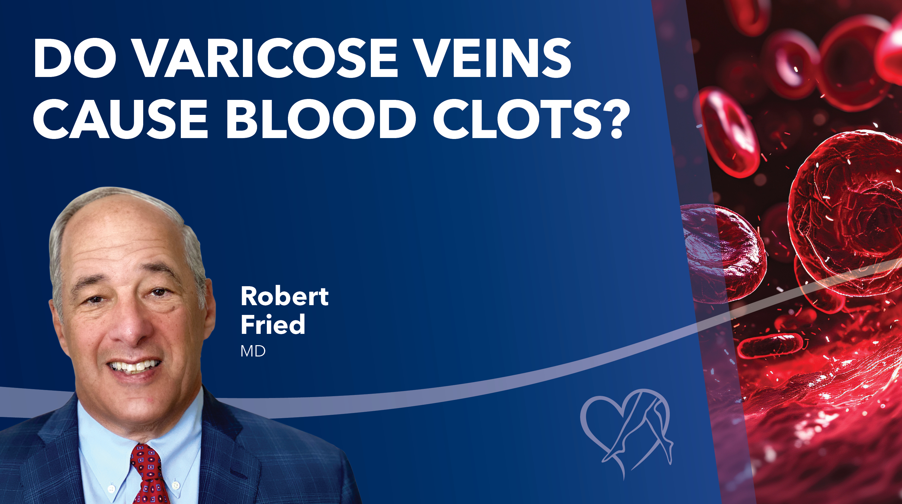 Blog Do Varicose Veins Cause Blood Clots Thumbnail
