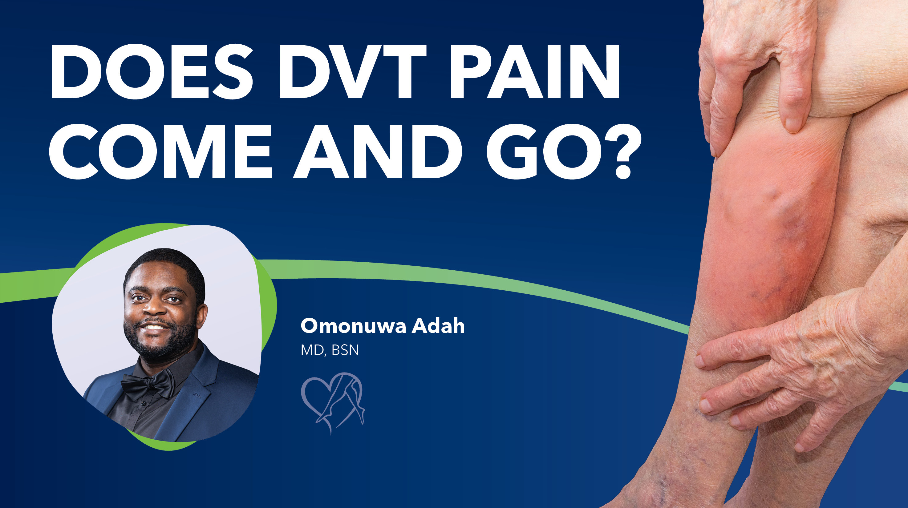 Blog Does DVT Come And Go Thumbnail v2