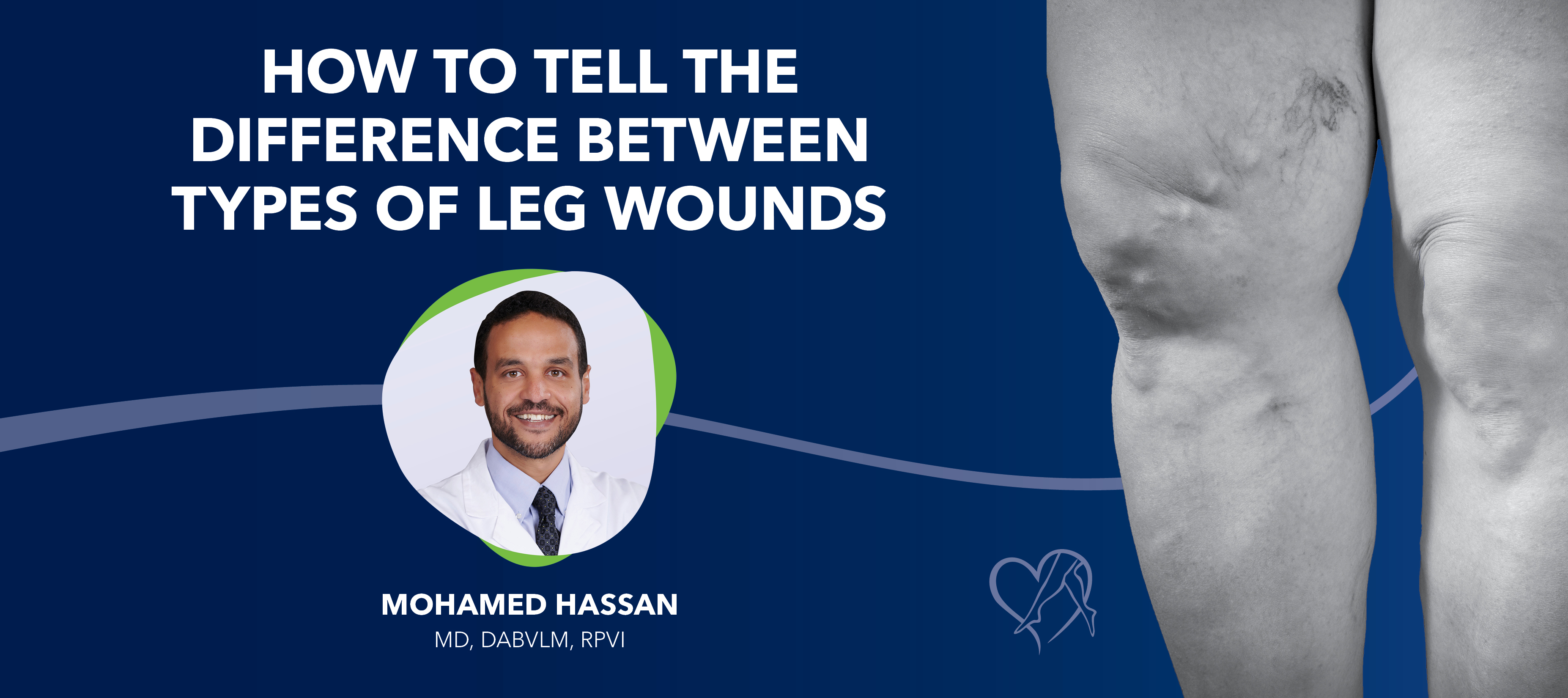 Blog Dr Hassan How to Tell the Difference Between Types of Leg Wounds