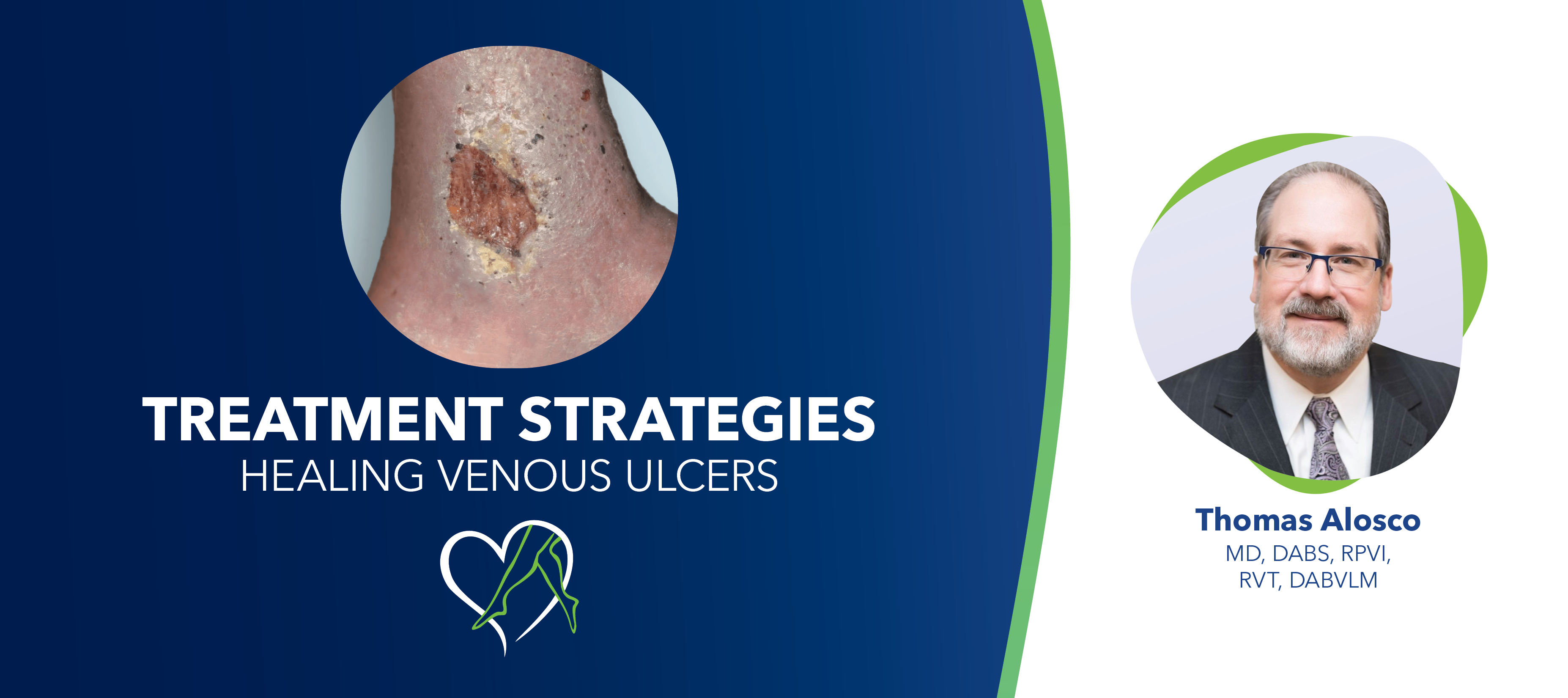 Blog Dr Alosco Venous Ulcers