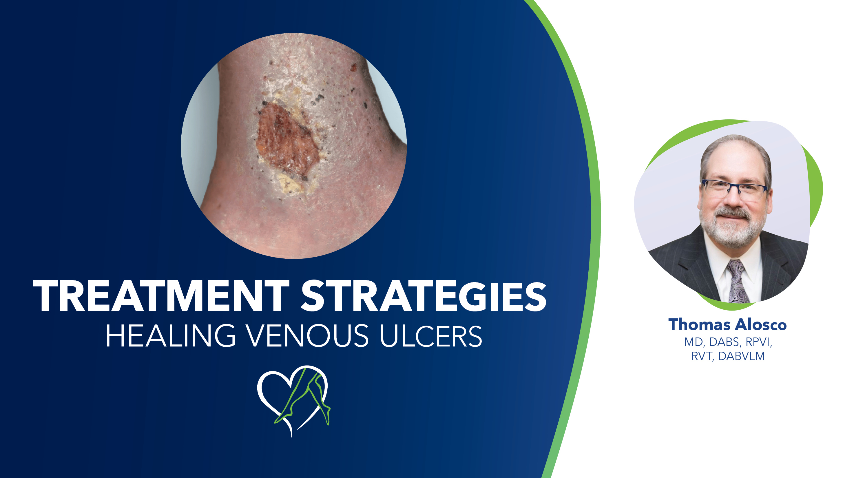 Blog Dr Alosco Venous Ulcers Thumbnail
