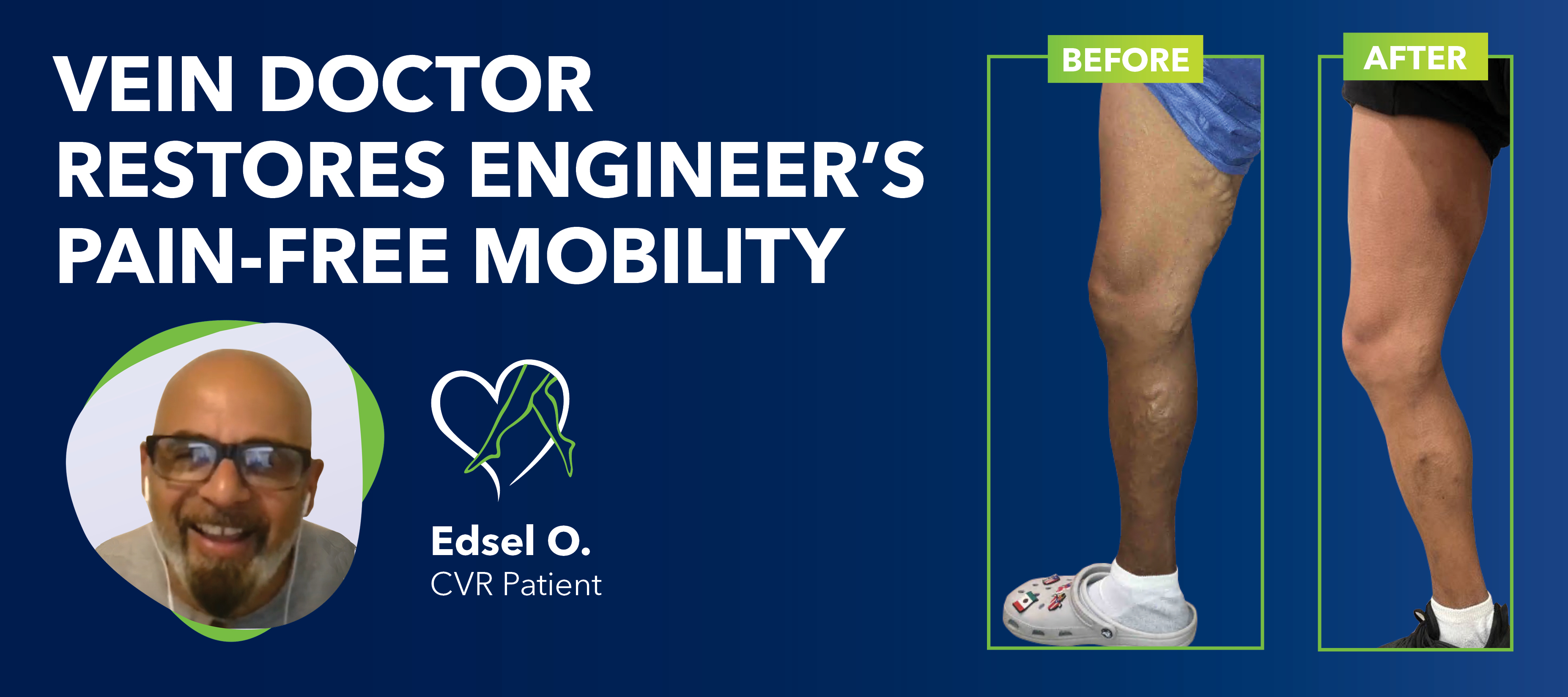 Blog Engineer Before After