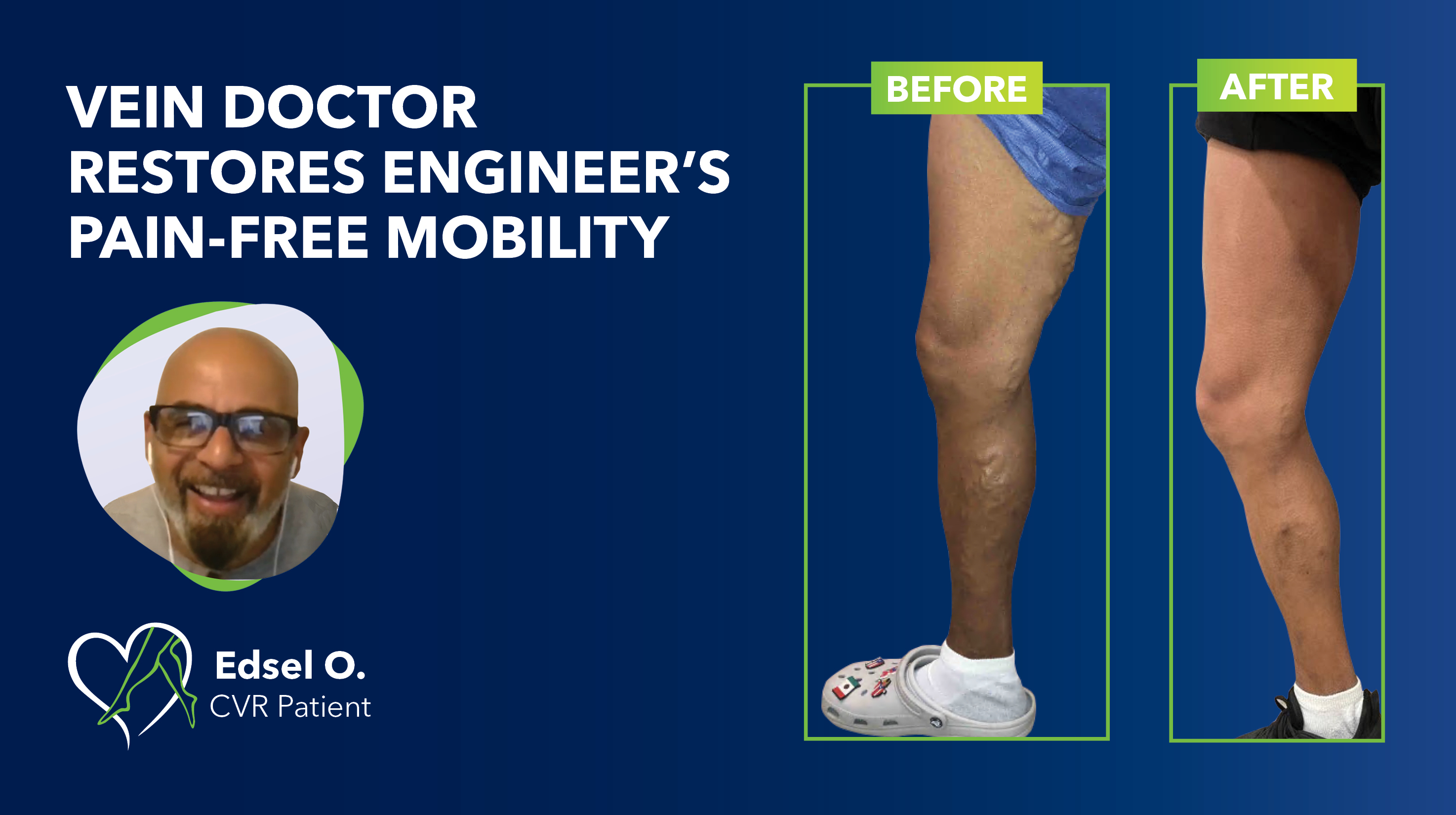 Blog Engineer Before After Thumbnail