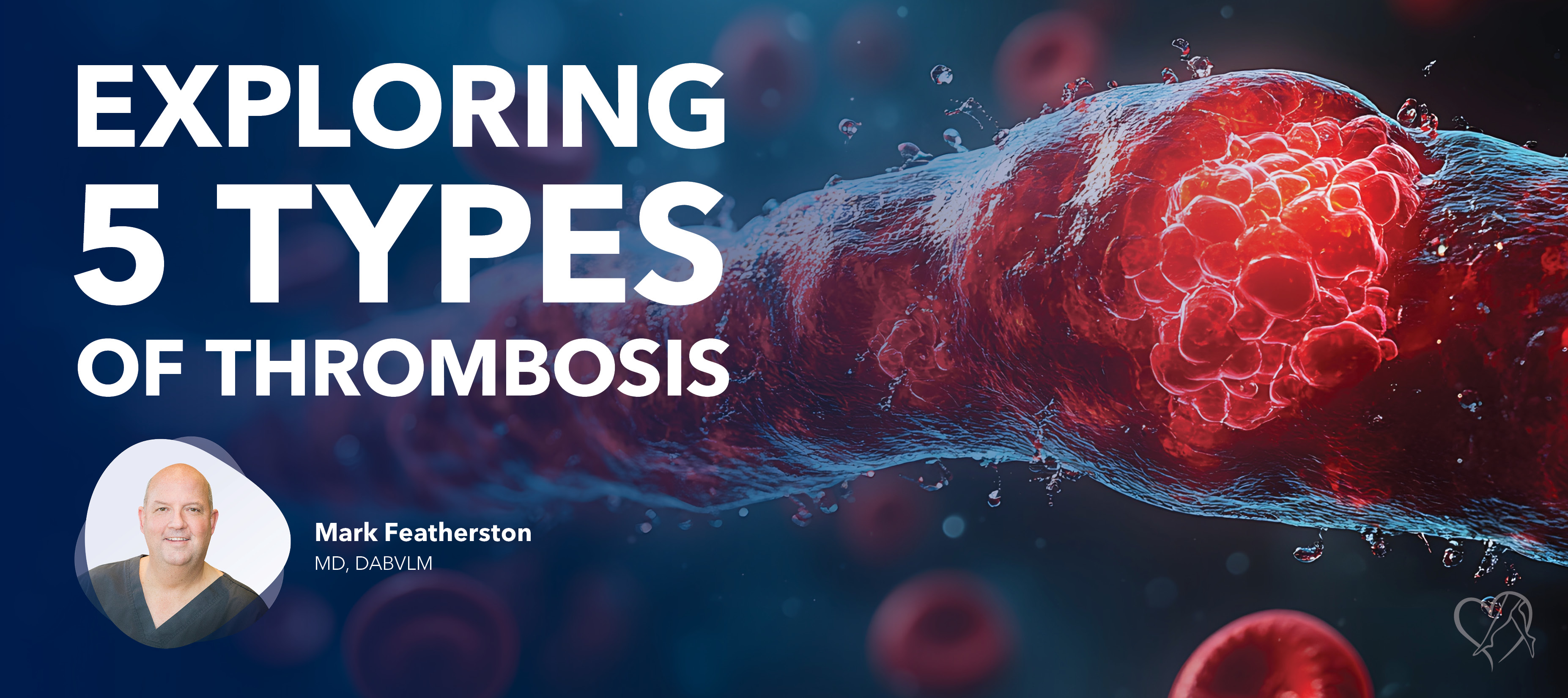 Blog Exploring5 Types Of Thrombosis