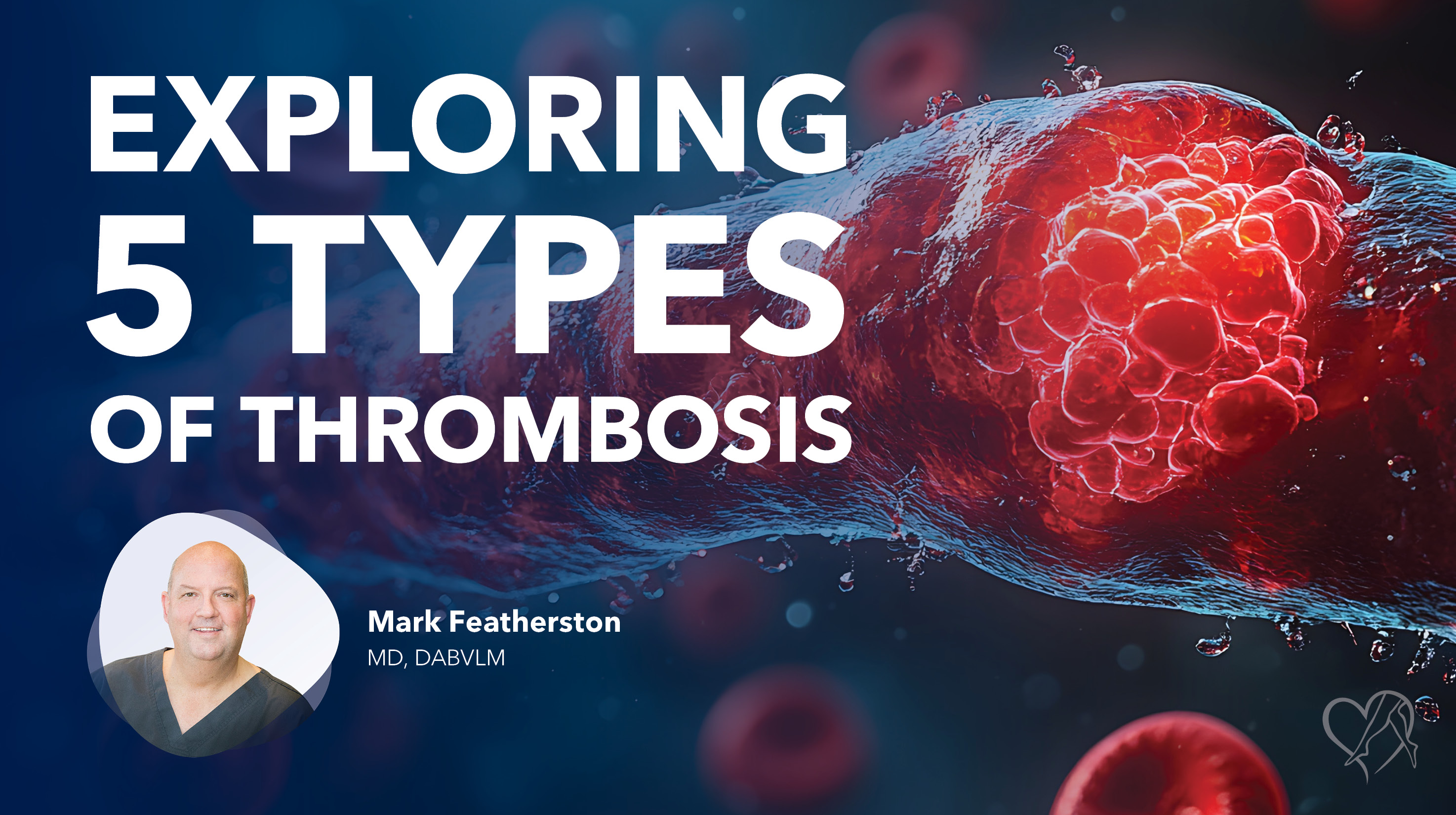 Blog Exploring5 Types Of Thrombosis Thumbnail